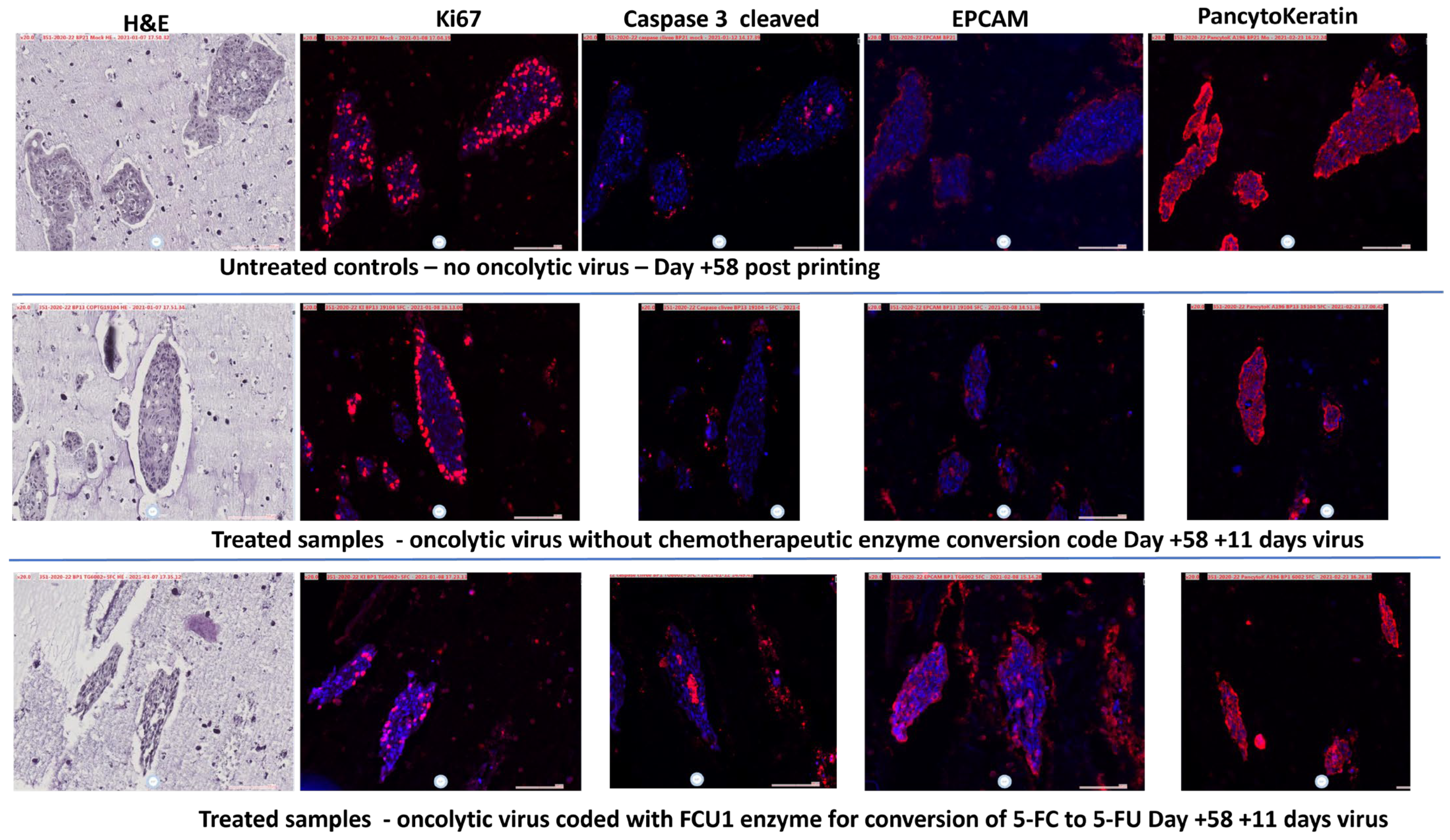 Cancers 17 03705 g006