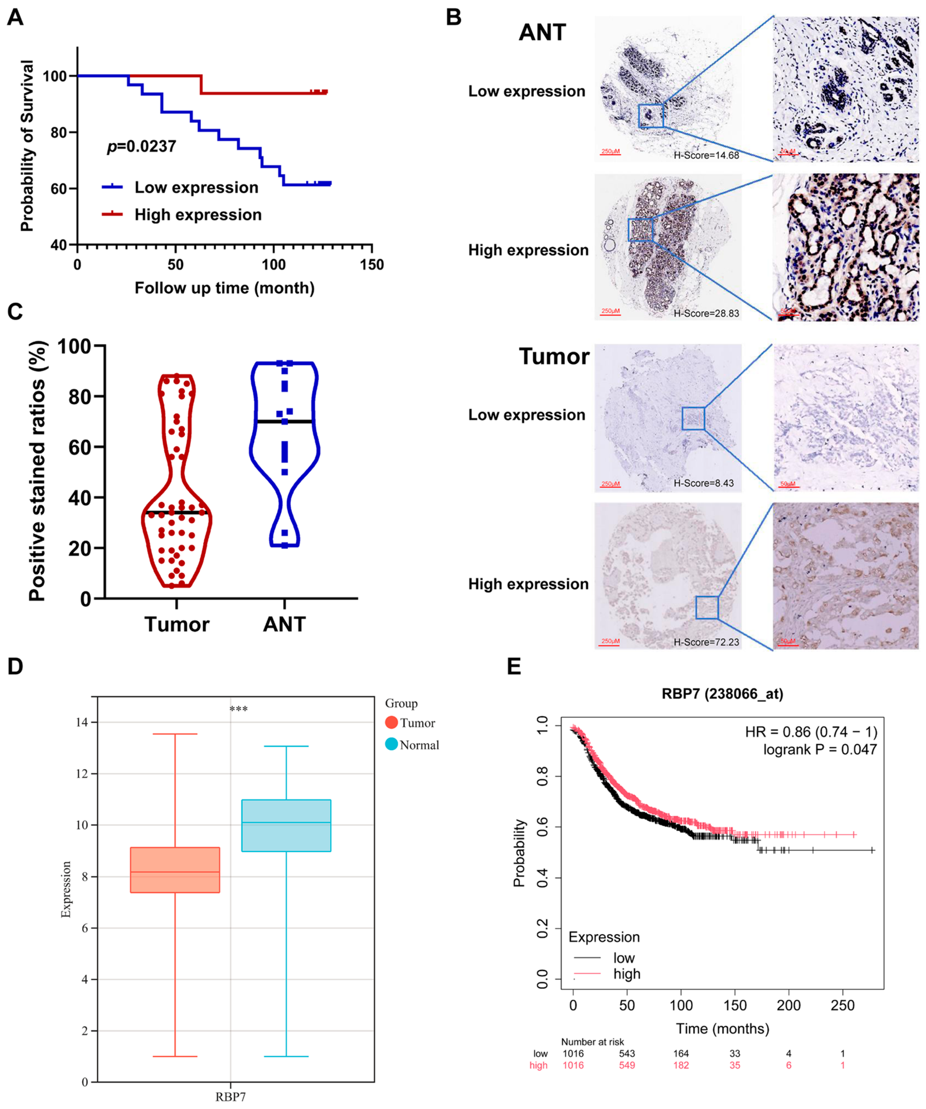 Cancers 17 03706 g007
