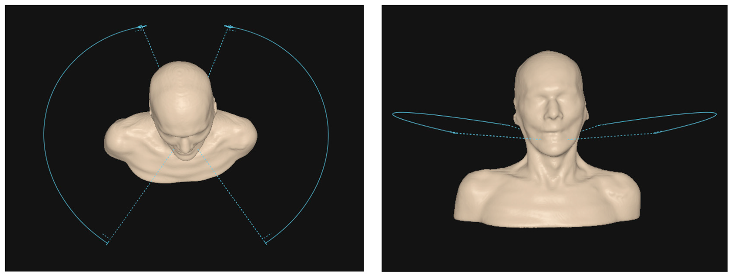 Cancers 17 03724 g002