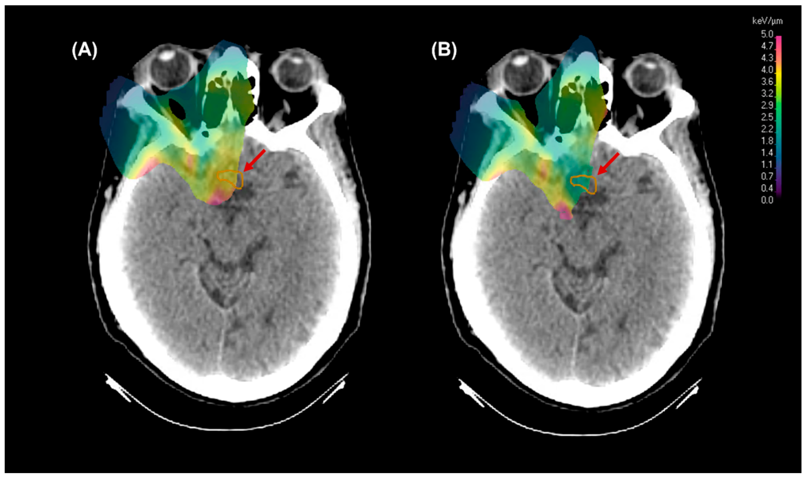 Cancers 17 03724 g003