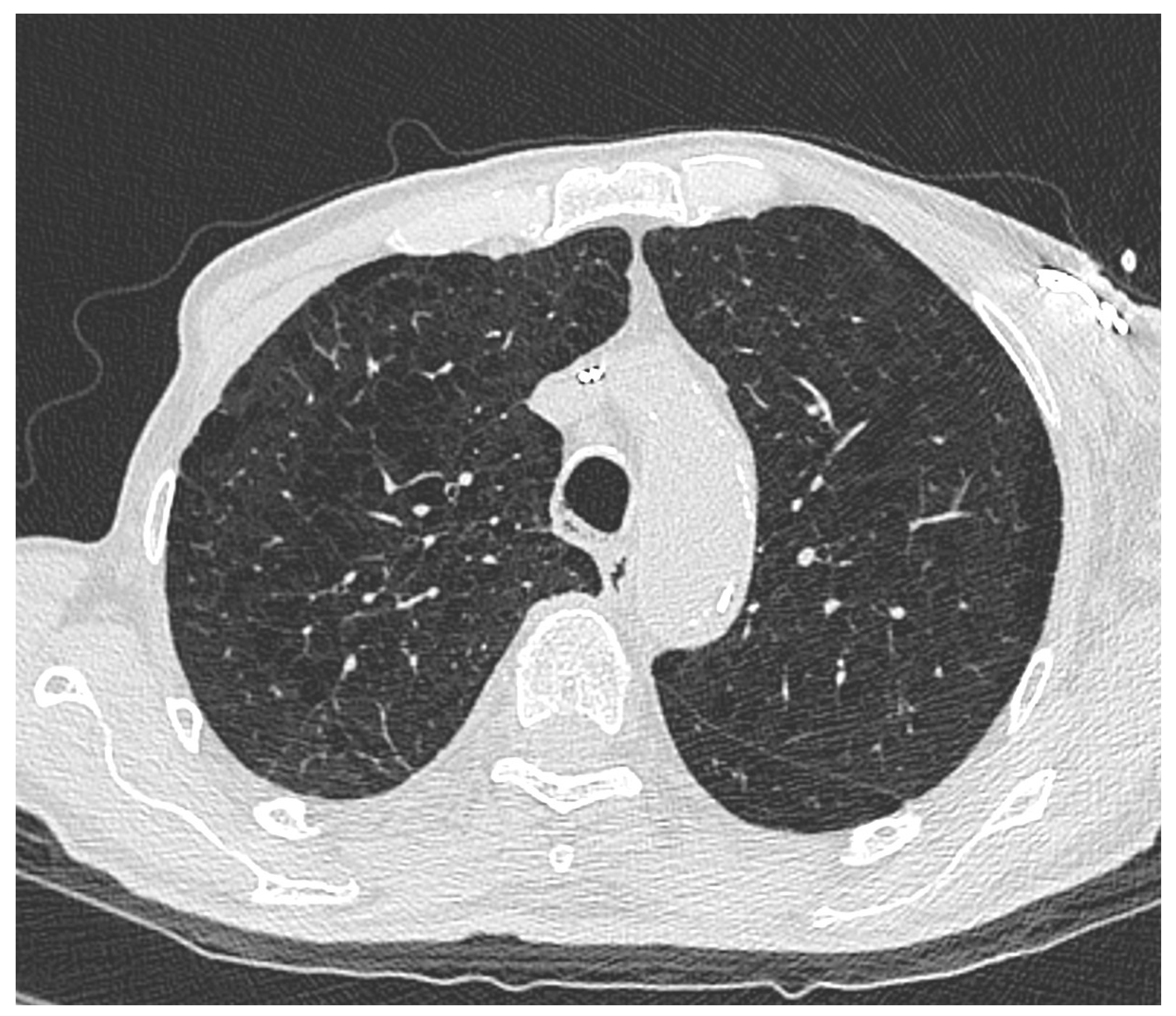 Cancers 17 03741 g002