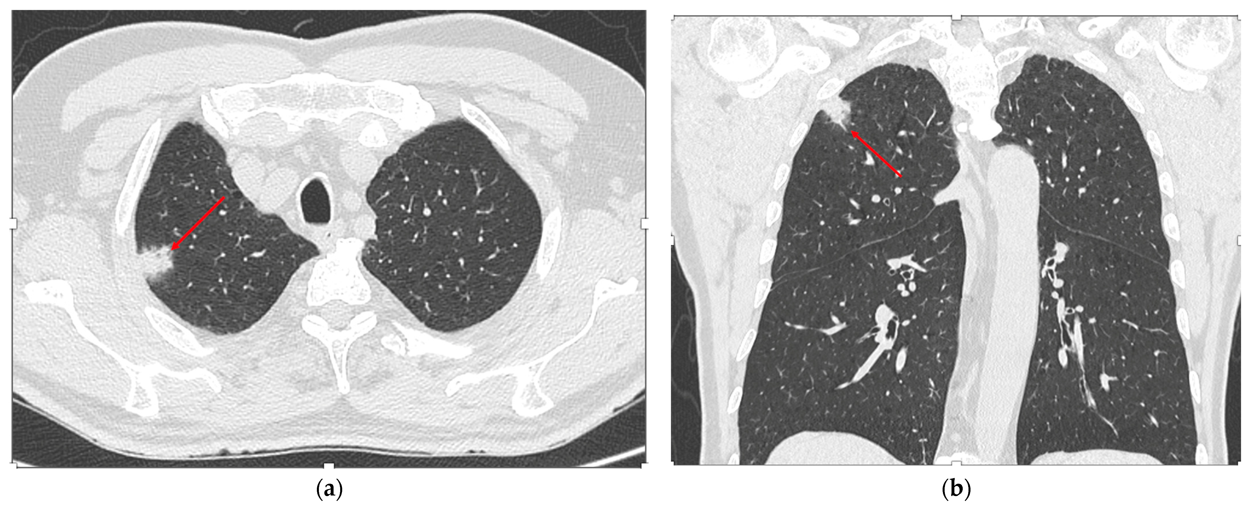Cancers 17 03741 g003