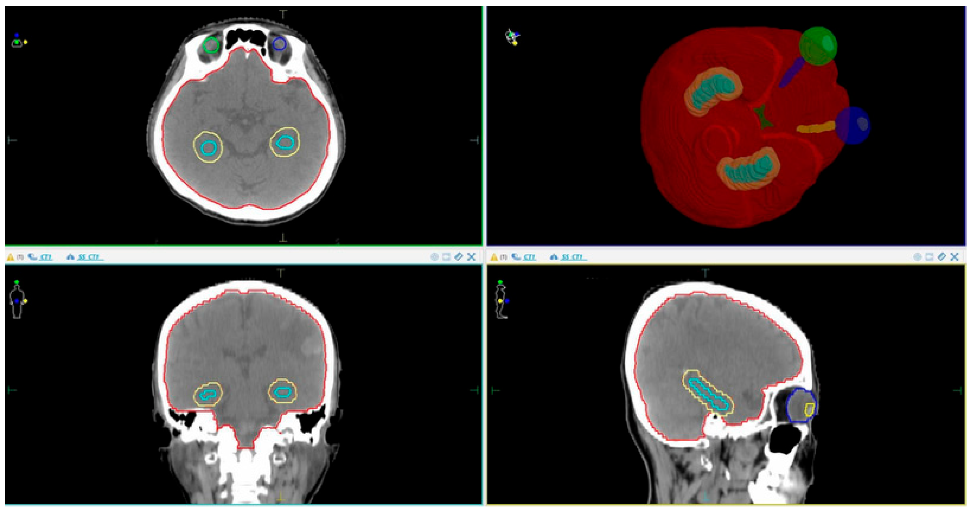Cancers 17 03744 g001