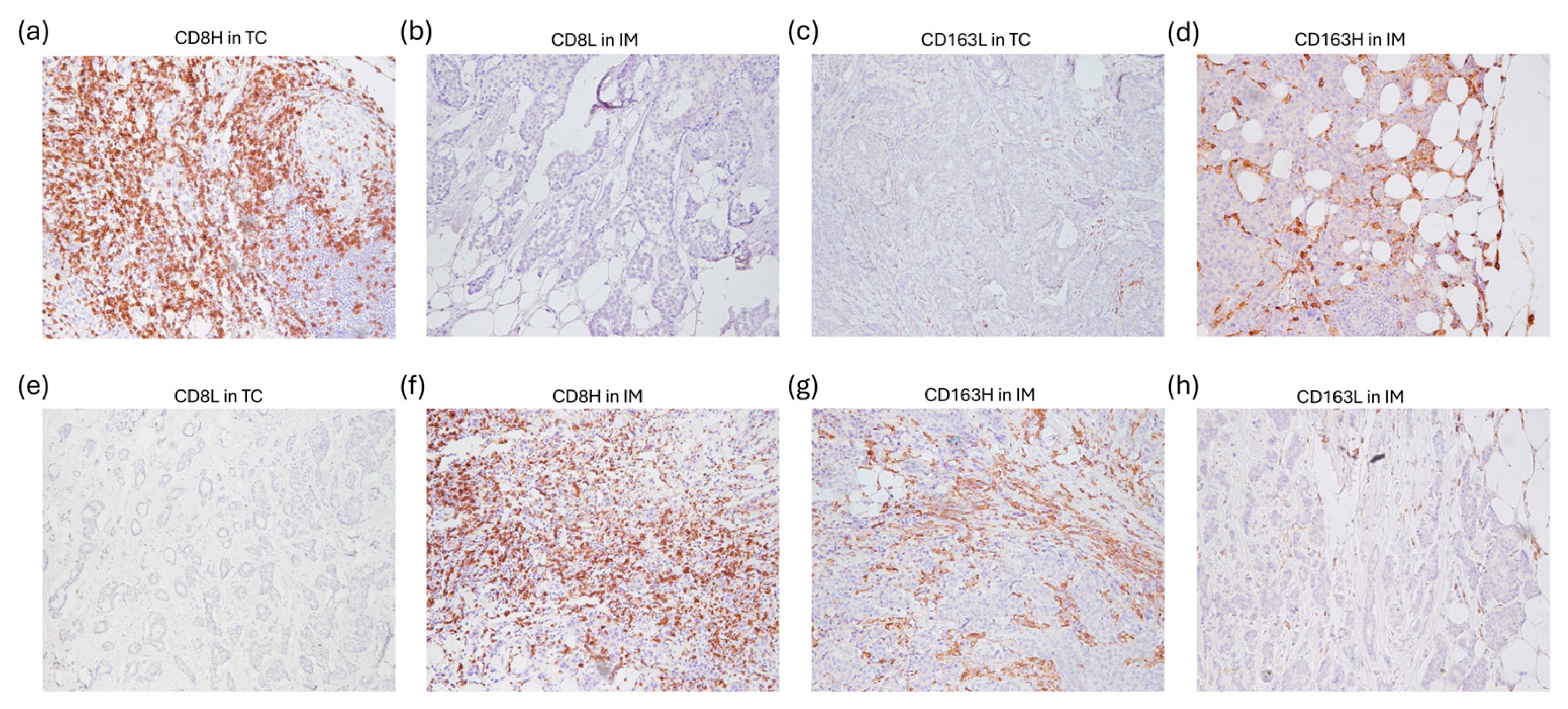 Cancers 17 03754 g002