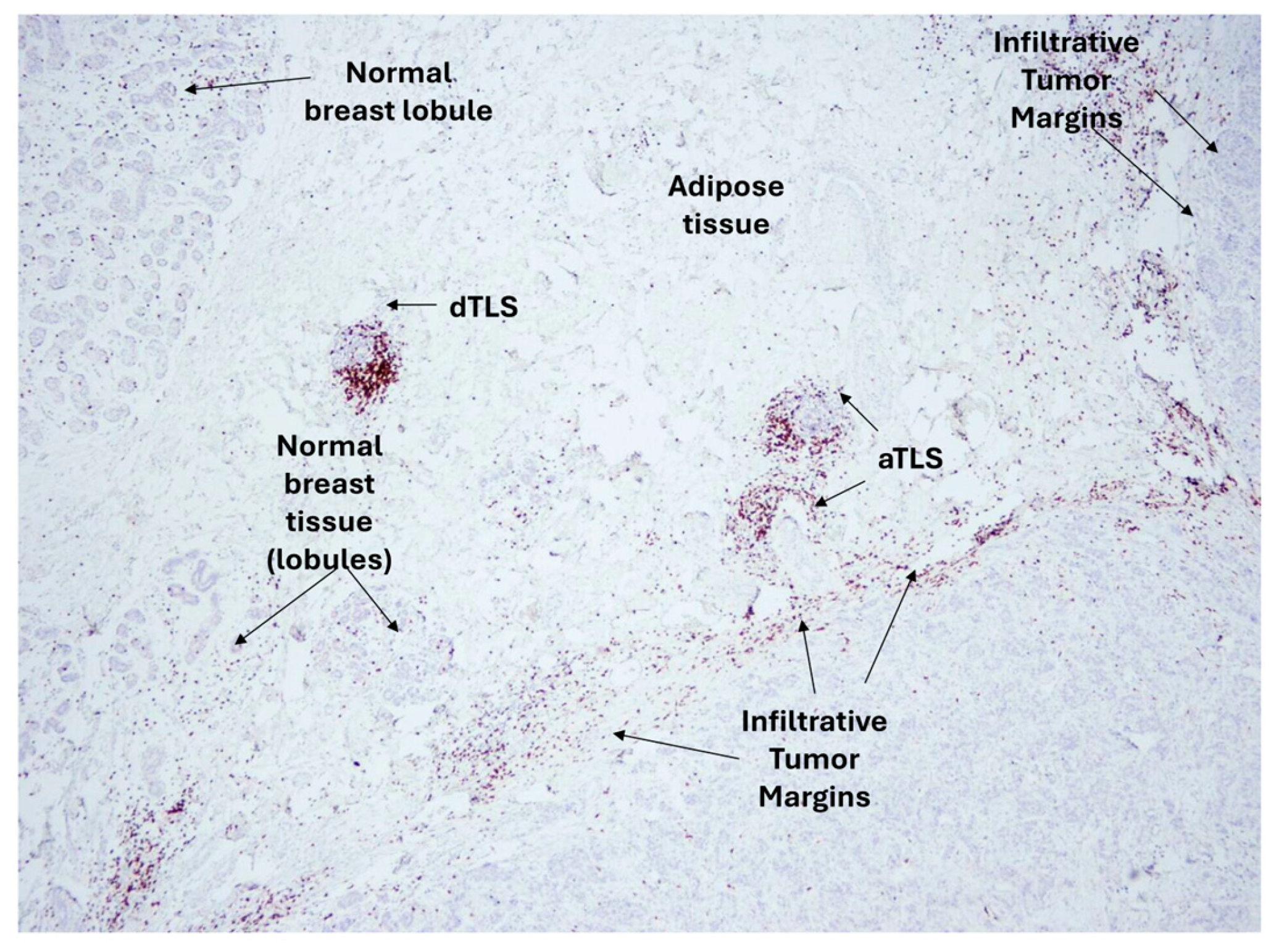 Cancers 17 03754 g004