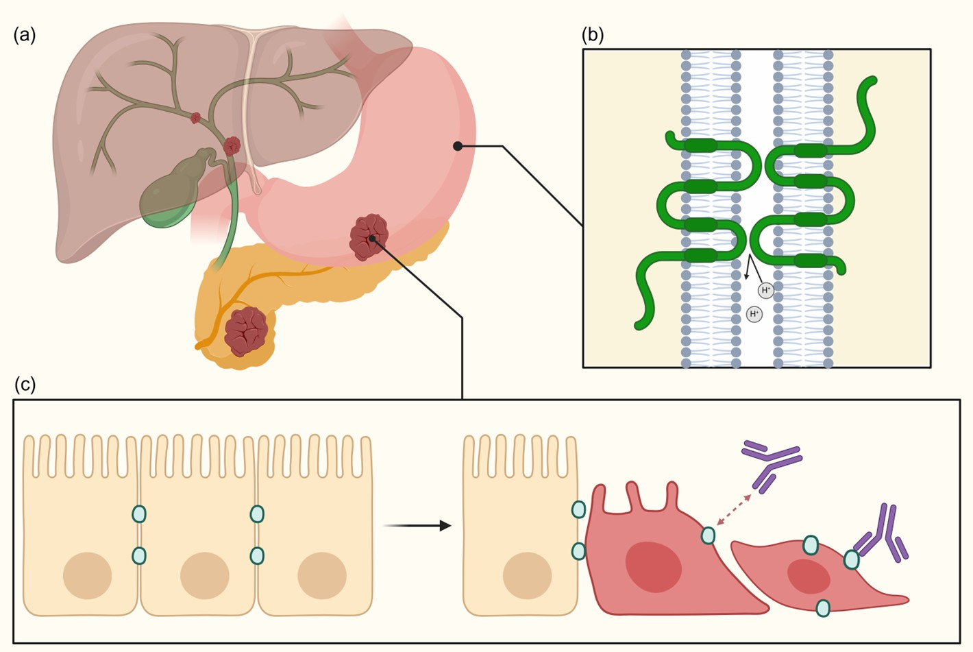 Cancers 17 03764 g001