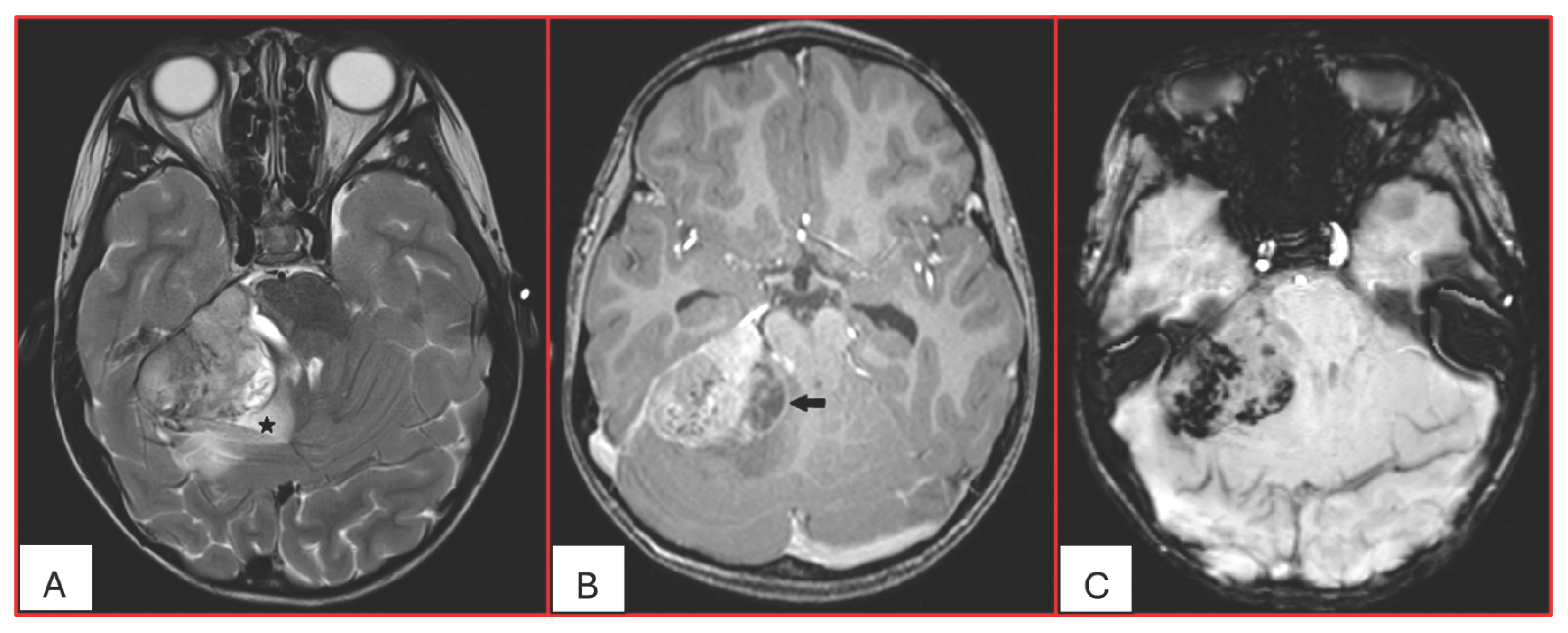 Cancers 17 03768 g001