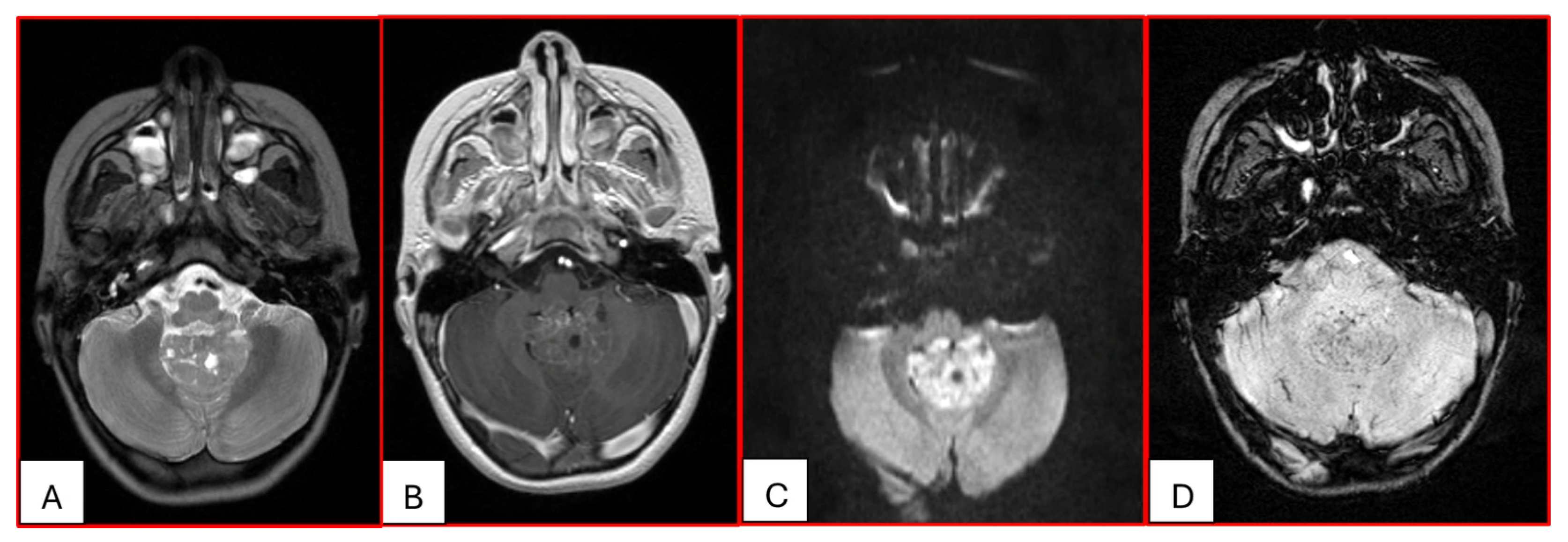 Cancers 17 03768 g003