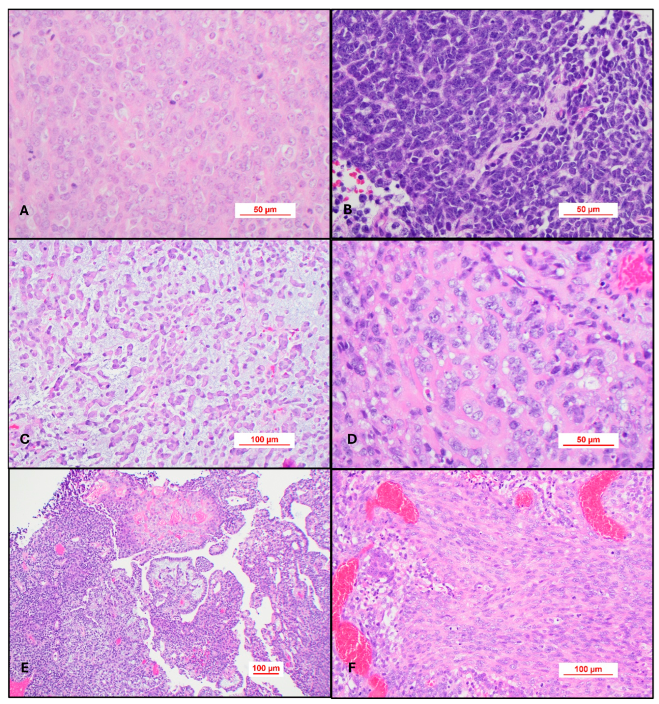 Cancers 17 03768 g004