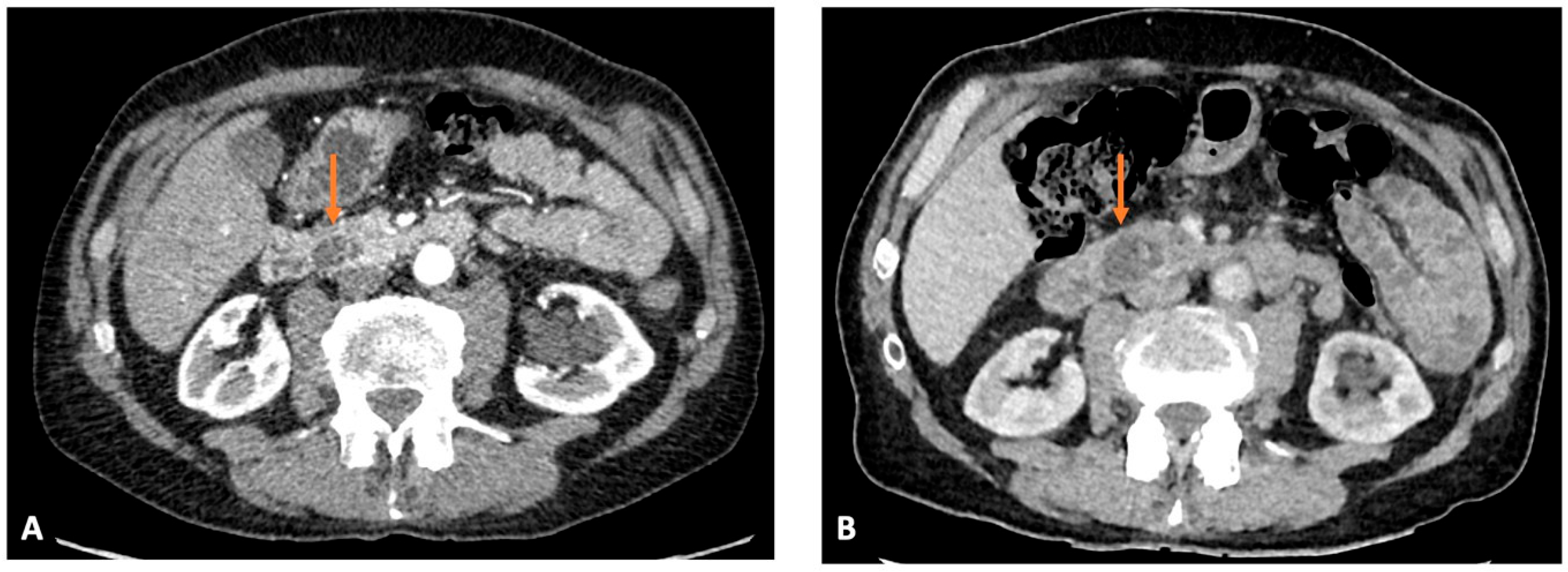 Cancers 17 03770 g001 Cancers 17 03770 g001