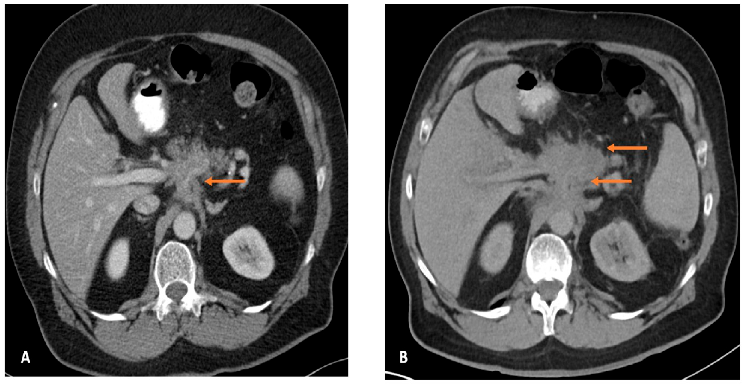 Cancers 17 03770 g002 Cancers 17 03770 g002