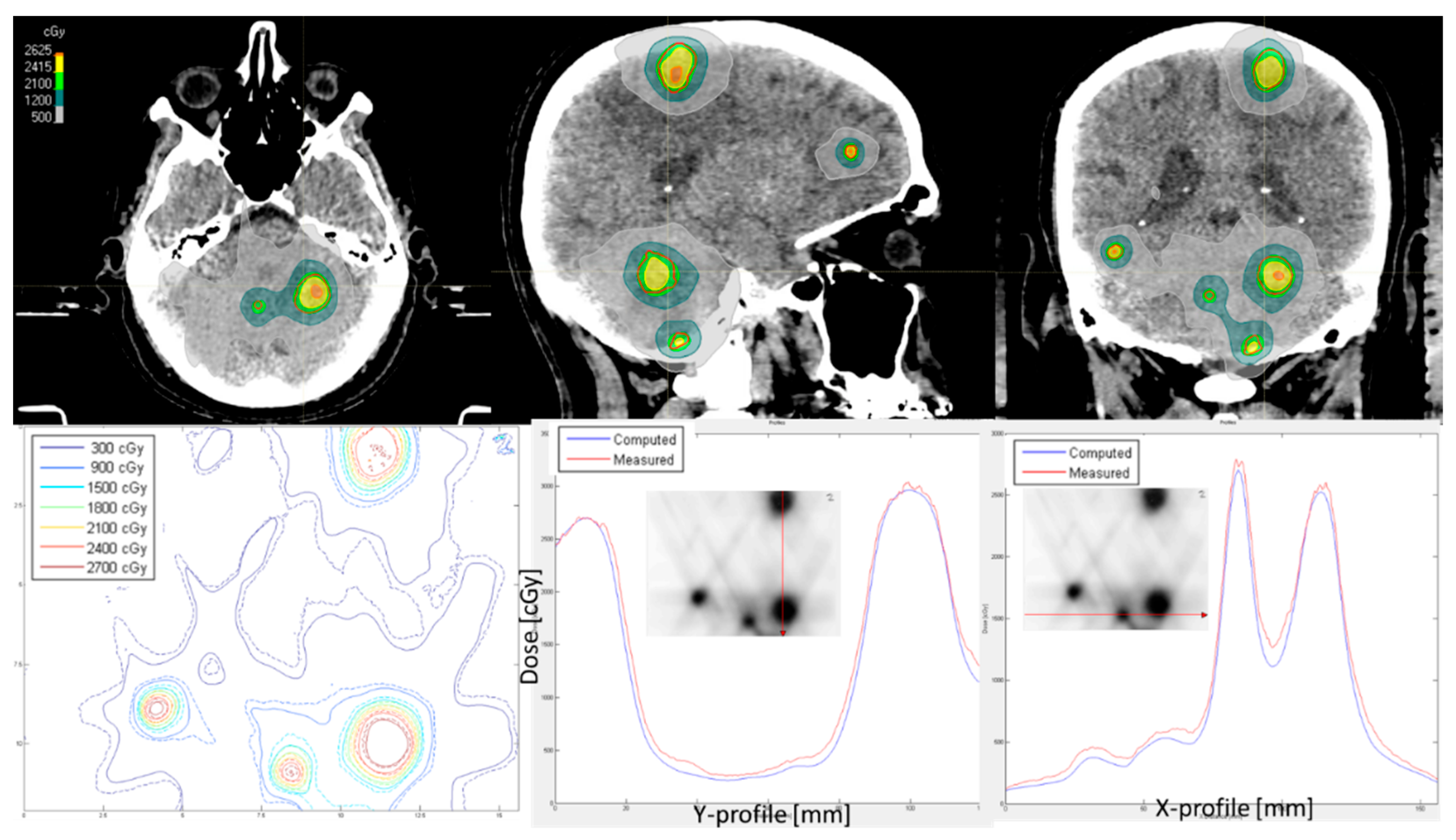 Cancers 17 03776 g003