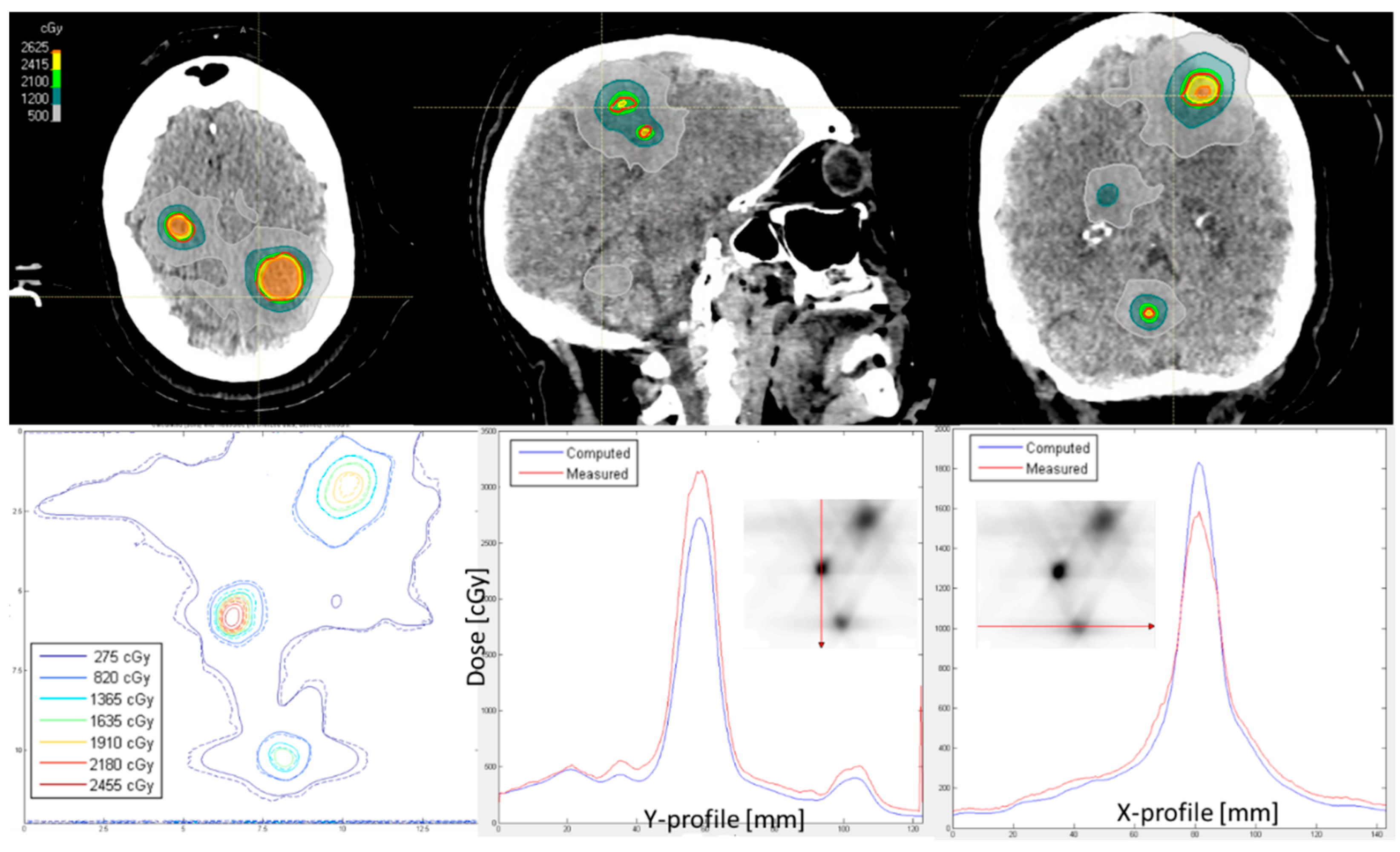 Cancers 17 03776 g004