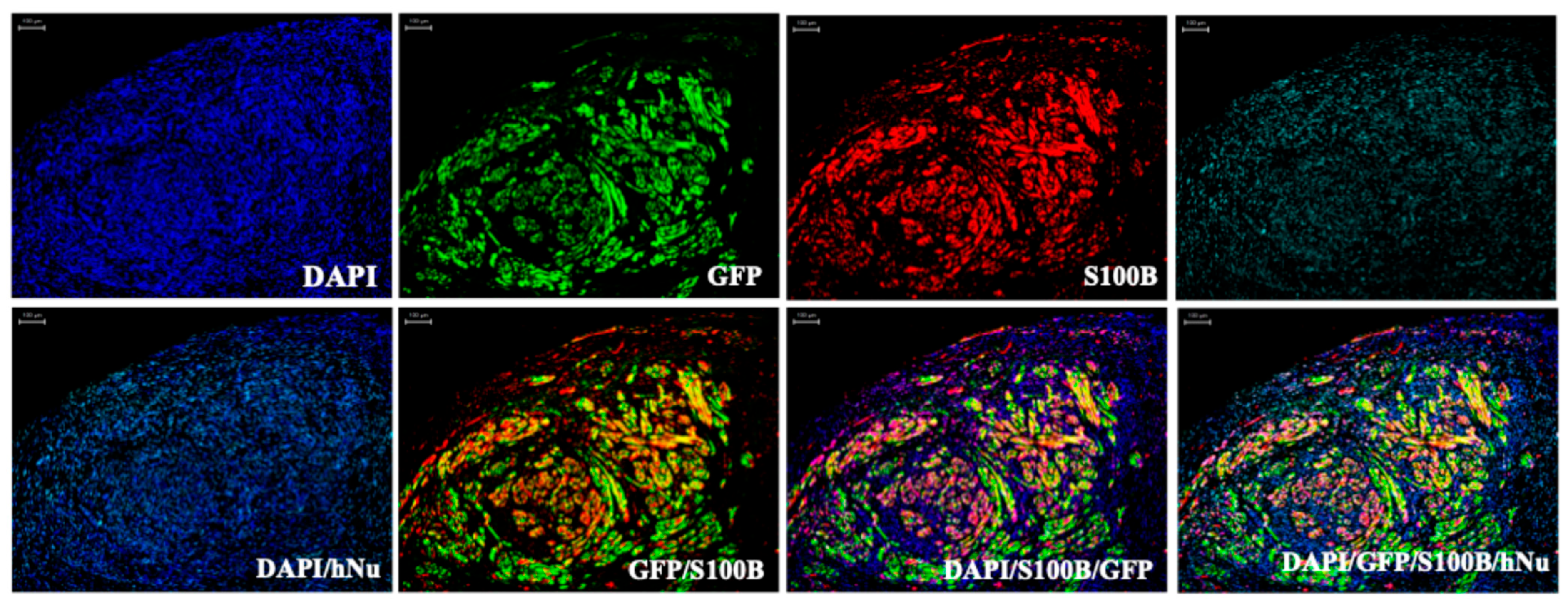 Cancers 17 03788 g003