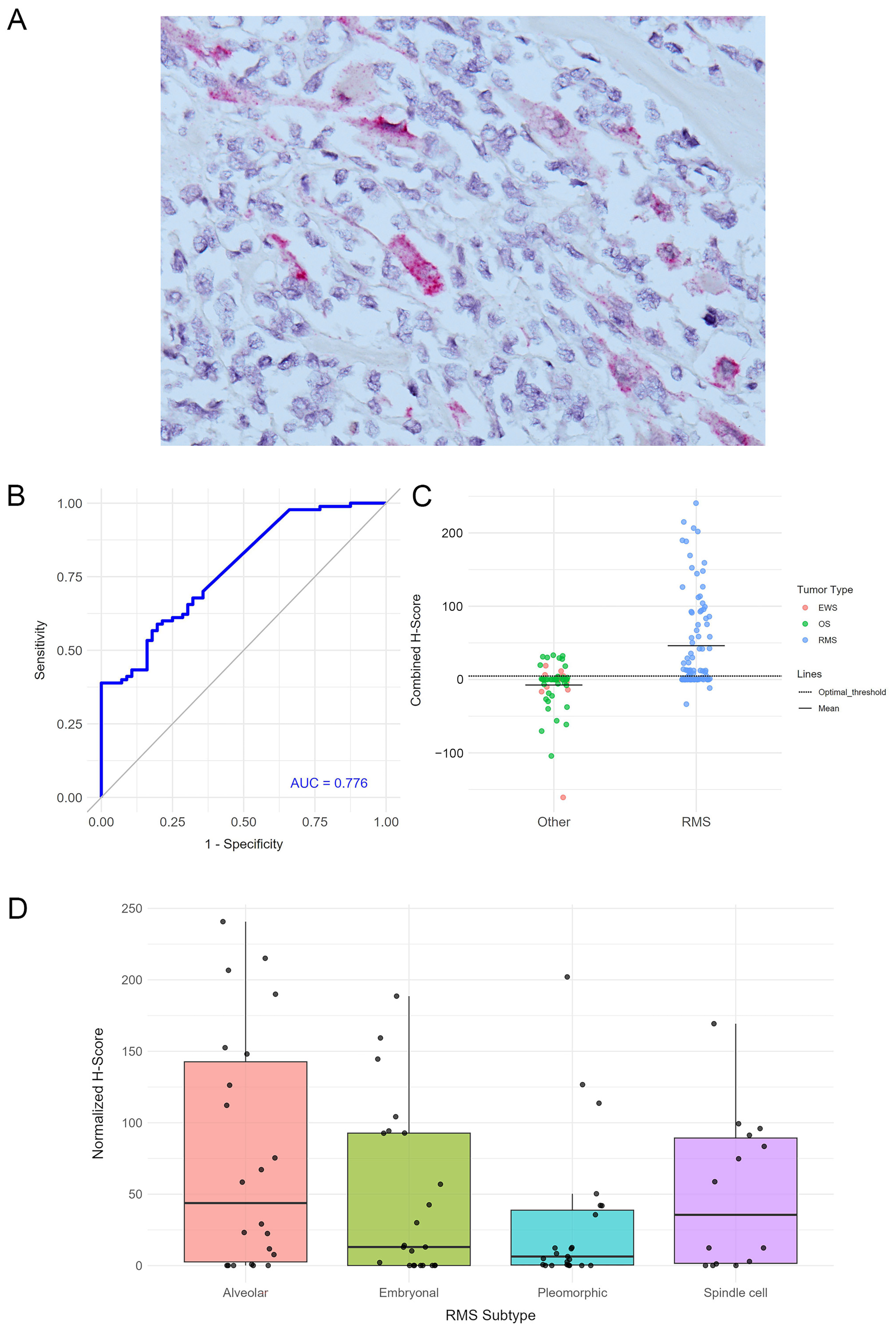Cancers 17 03791 g005