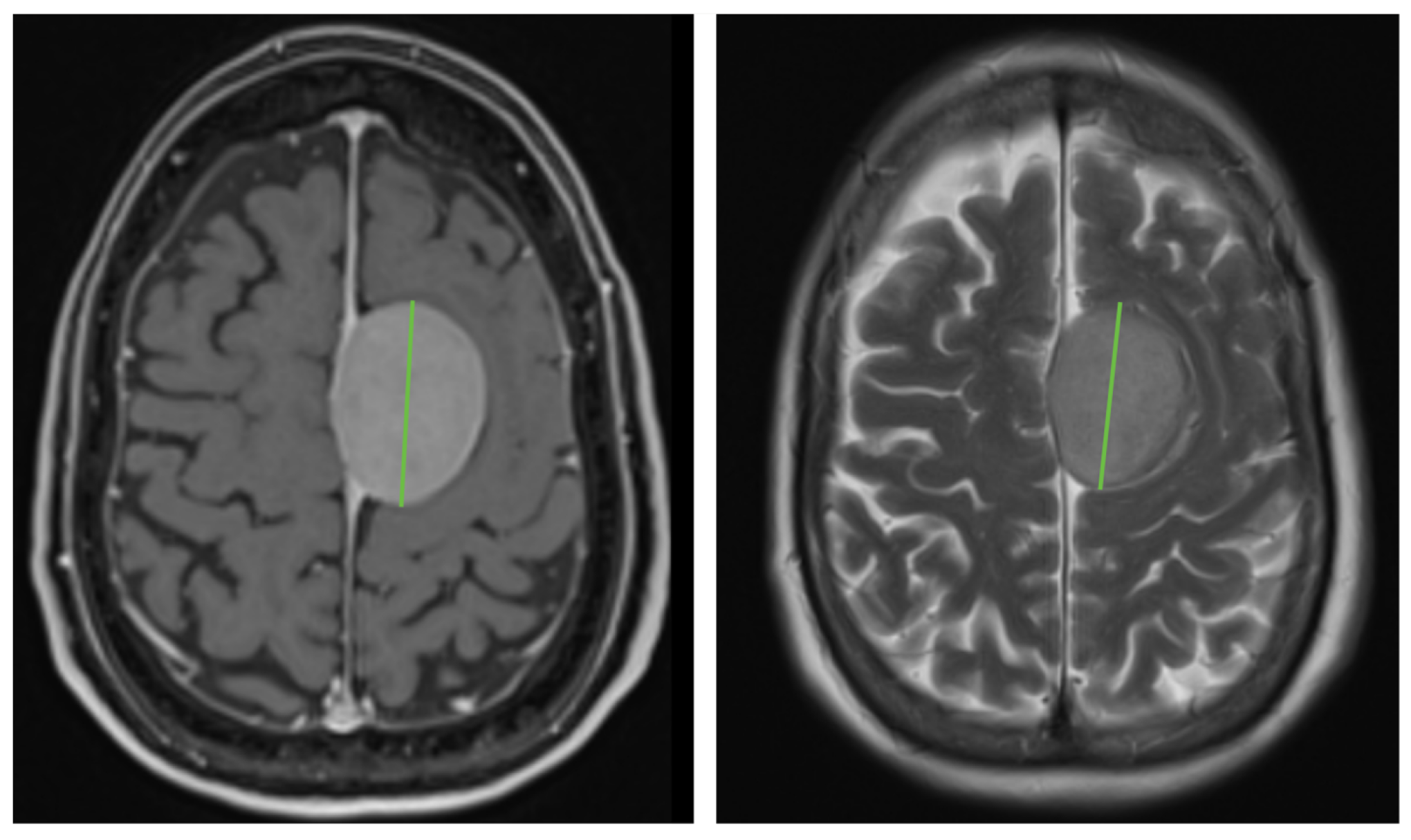 Cancers 17 03800 g001 Cancers 17 03800 g001