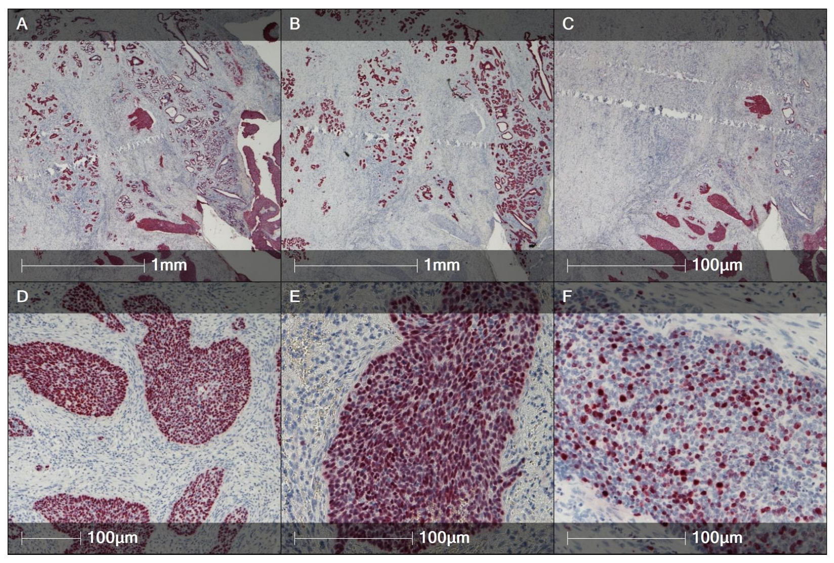 Cancers 17 03819 g002