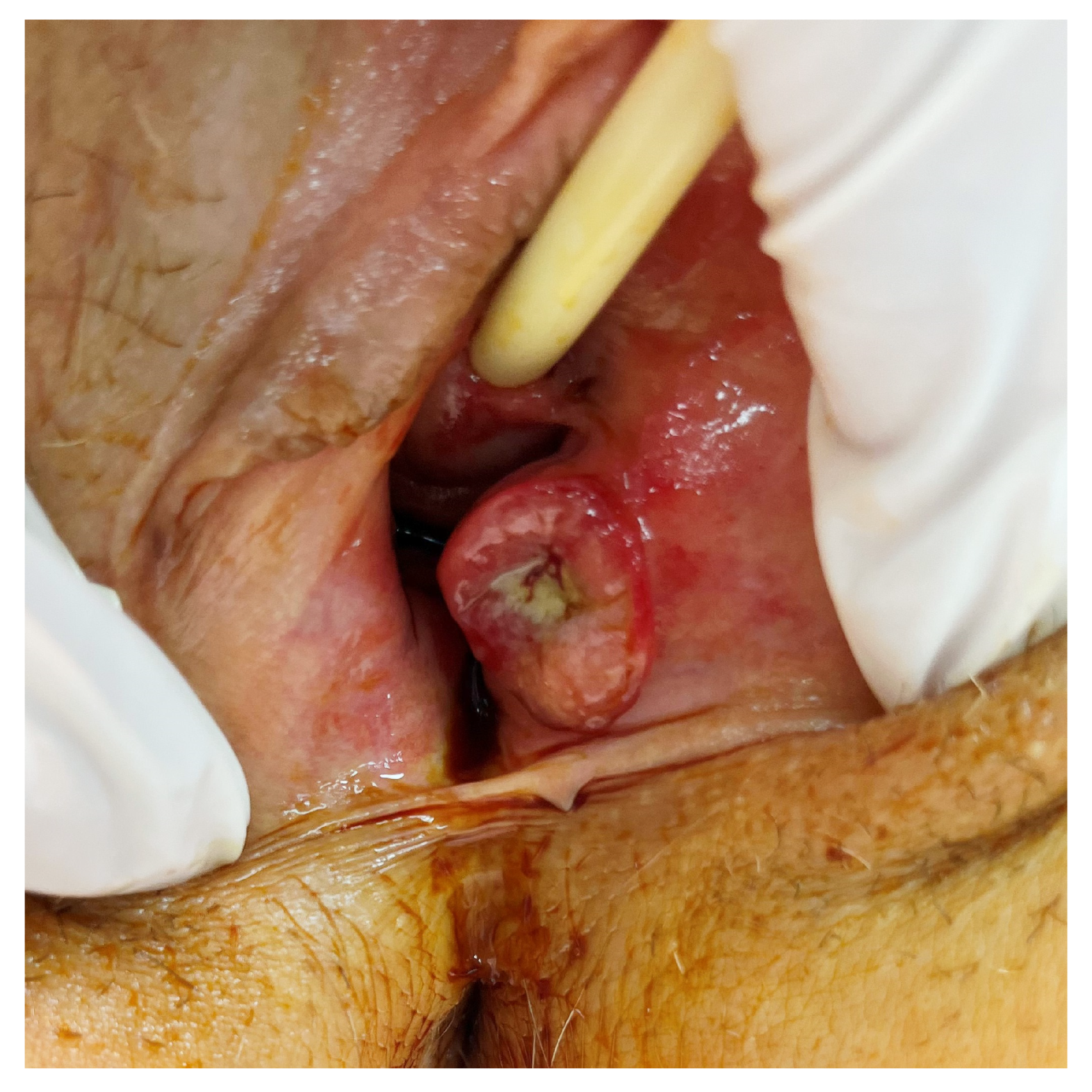 Cancers 17 03819 g003