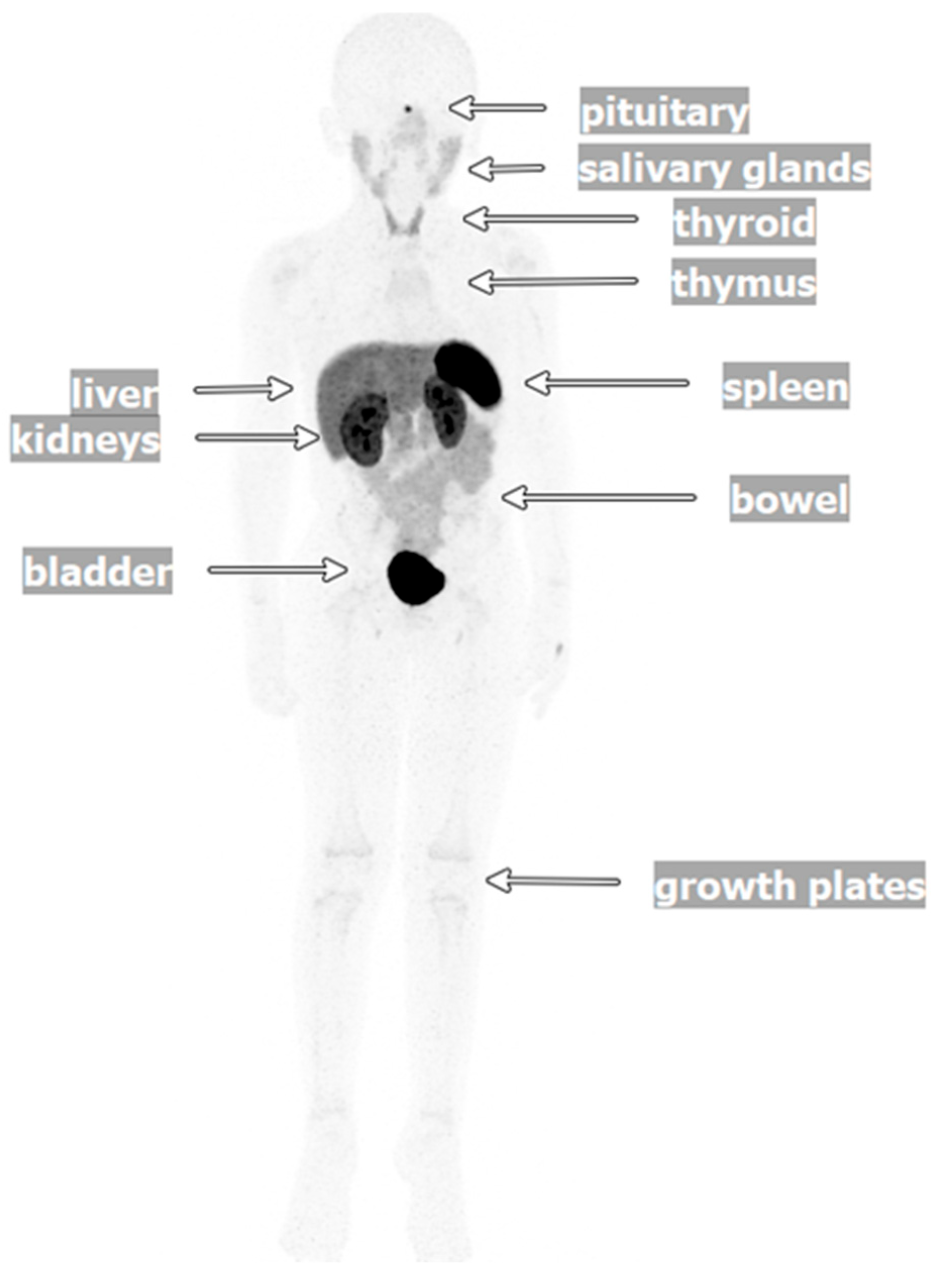 Cancers 17 03821 g002 Cancers 17 03821 g002
