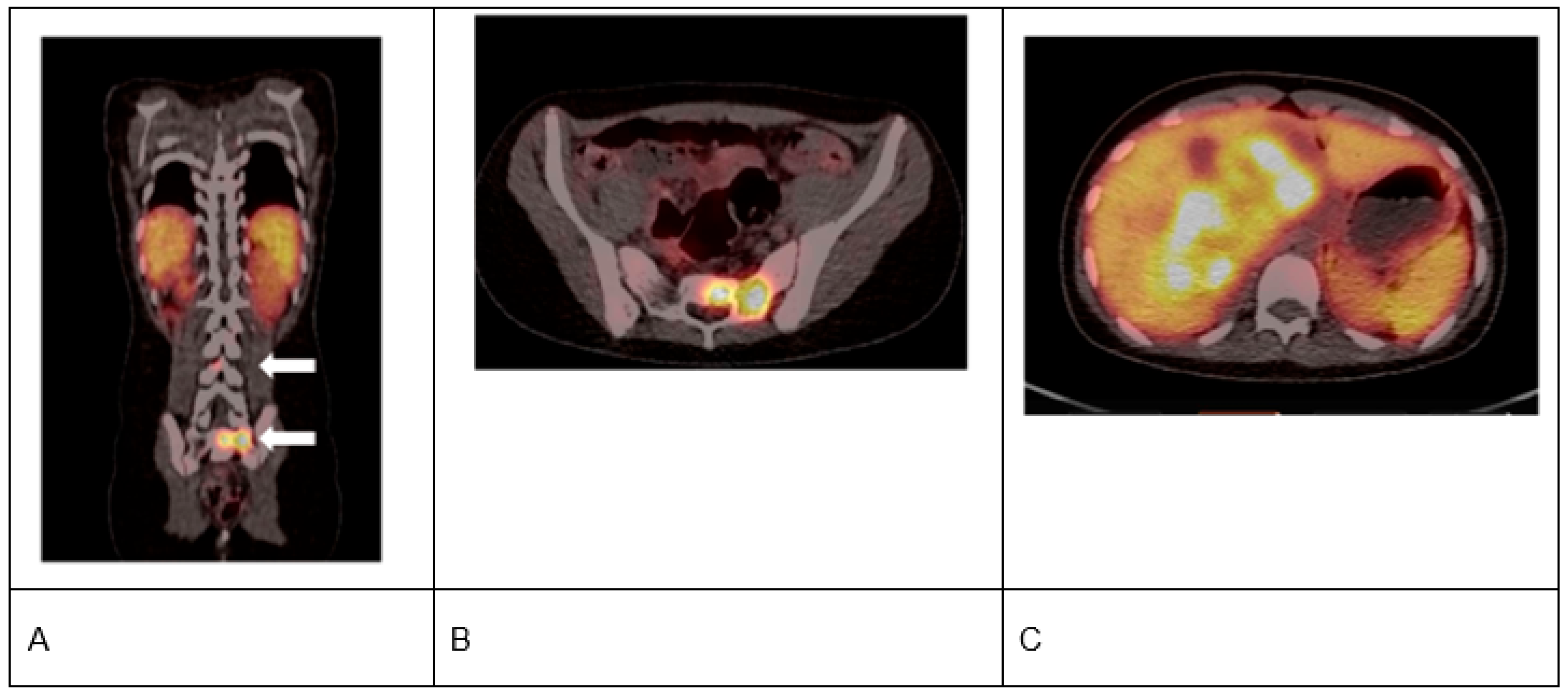 Cancers 17 03821 g003 Cancers 17 03821 g003