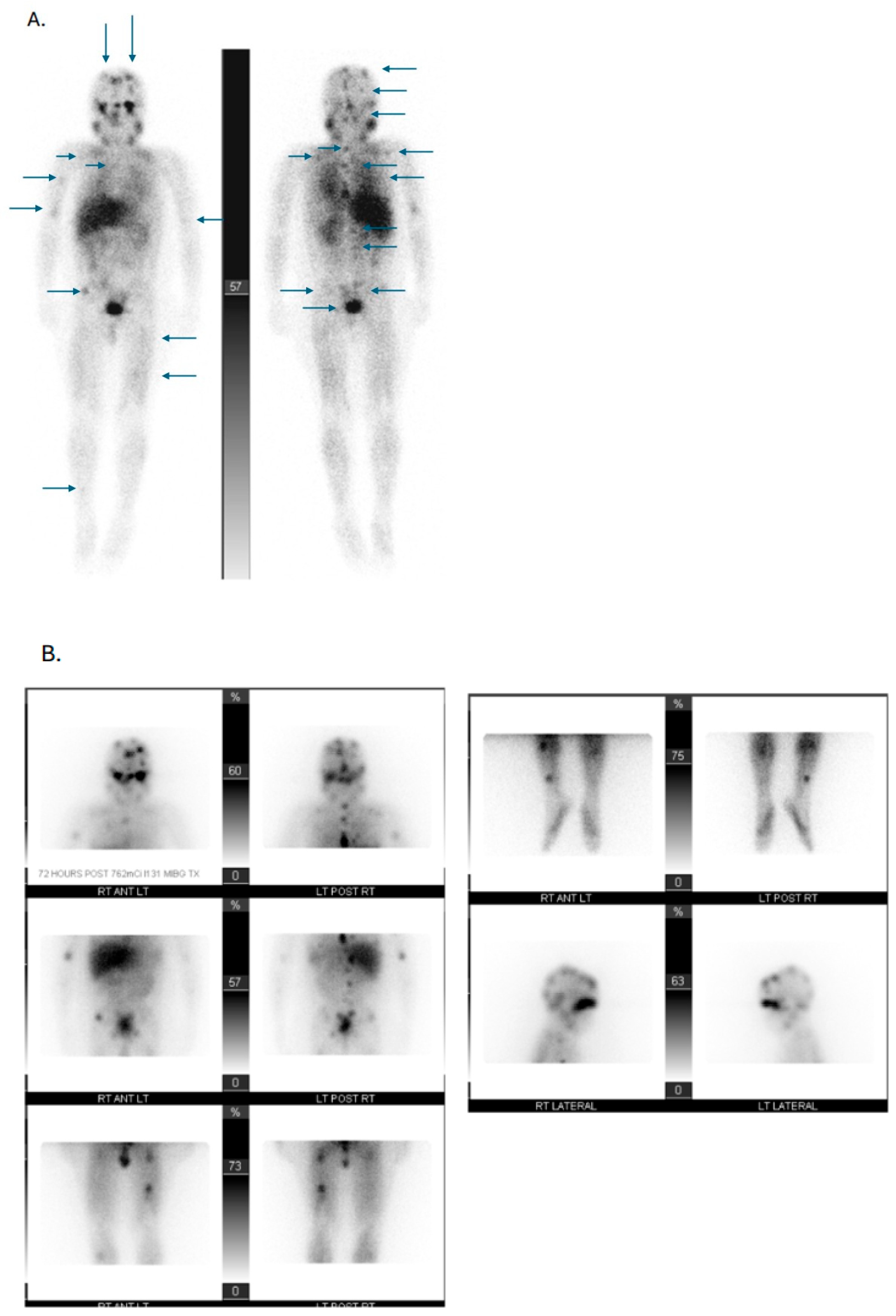 Cancers 17 03821 g004a Cancers 17 03821 g004a