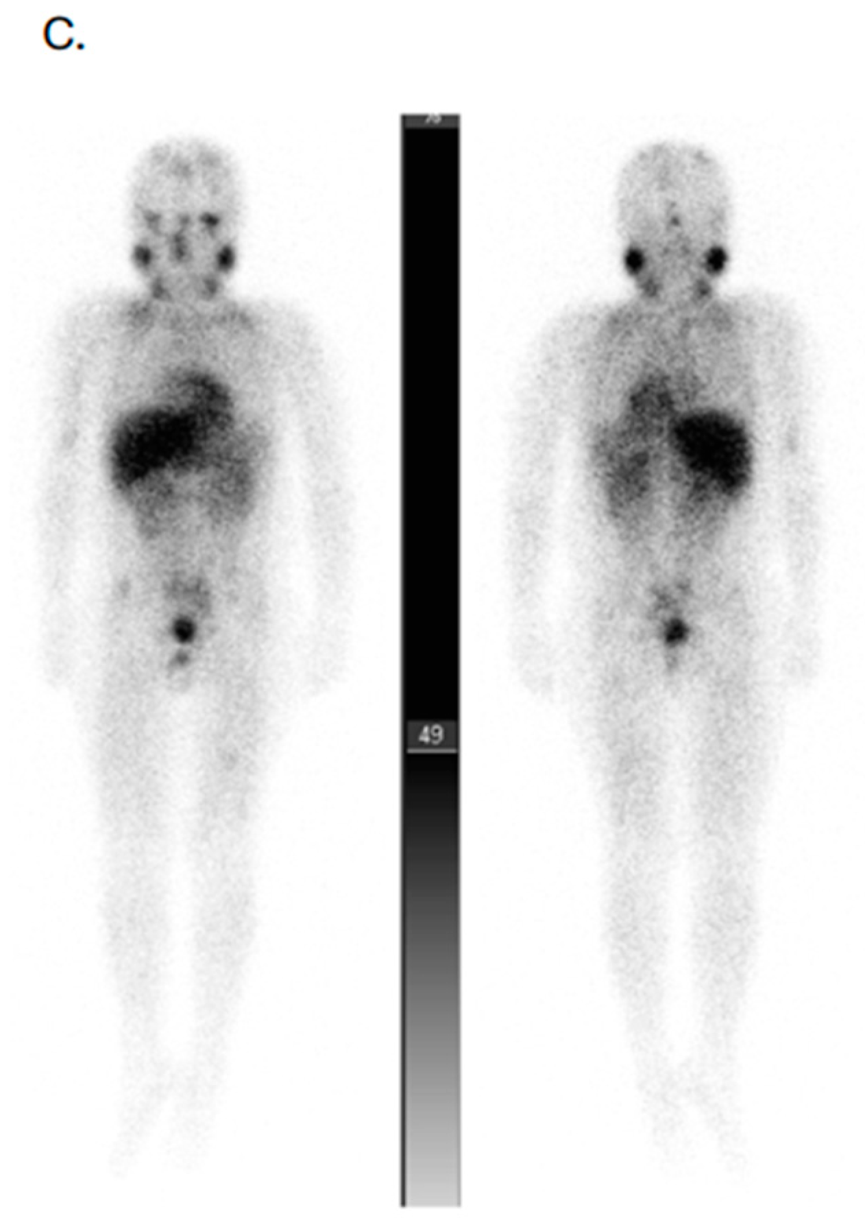 Cancers 17 03821 g004b Cancers 17 03821 g004b