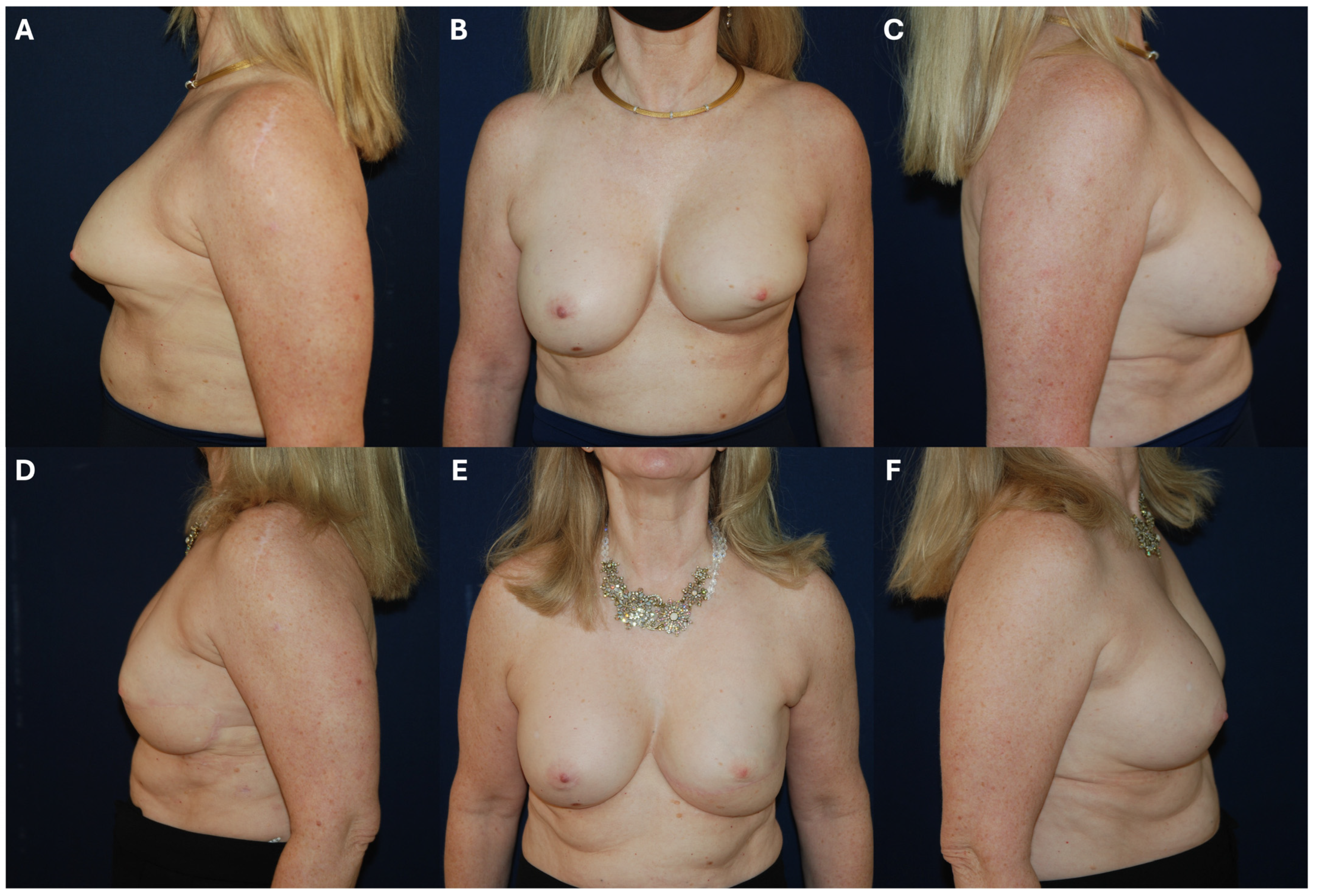 Cancers 17 03831 g002