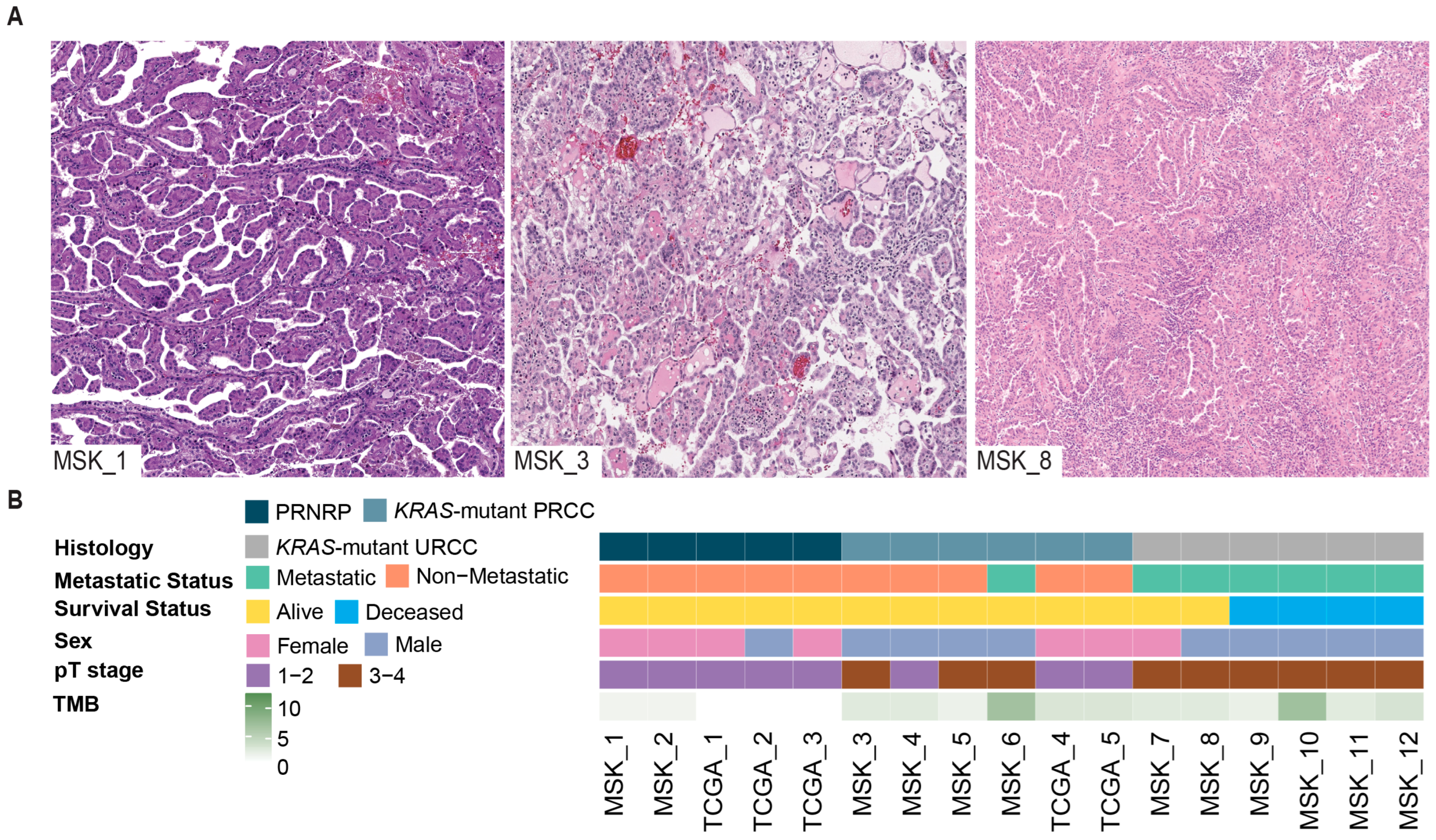 Cancers 17 03832 g001 Cancers 17 03832 g001