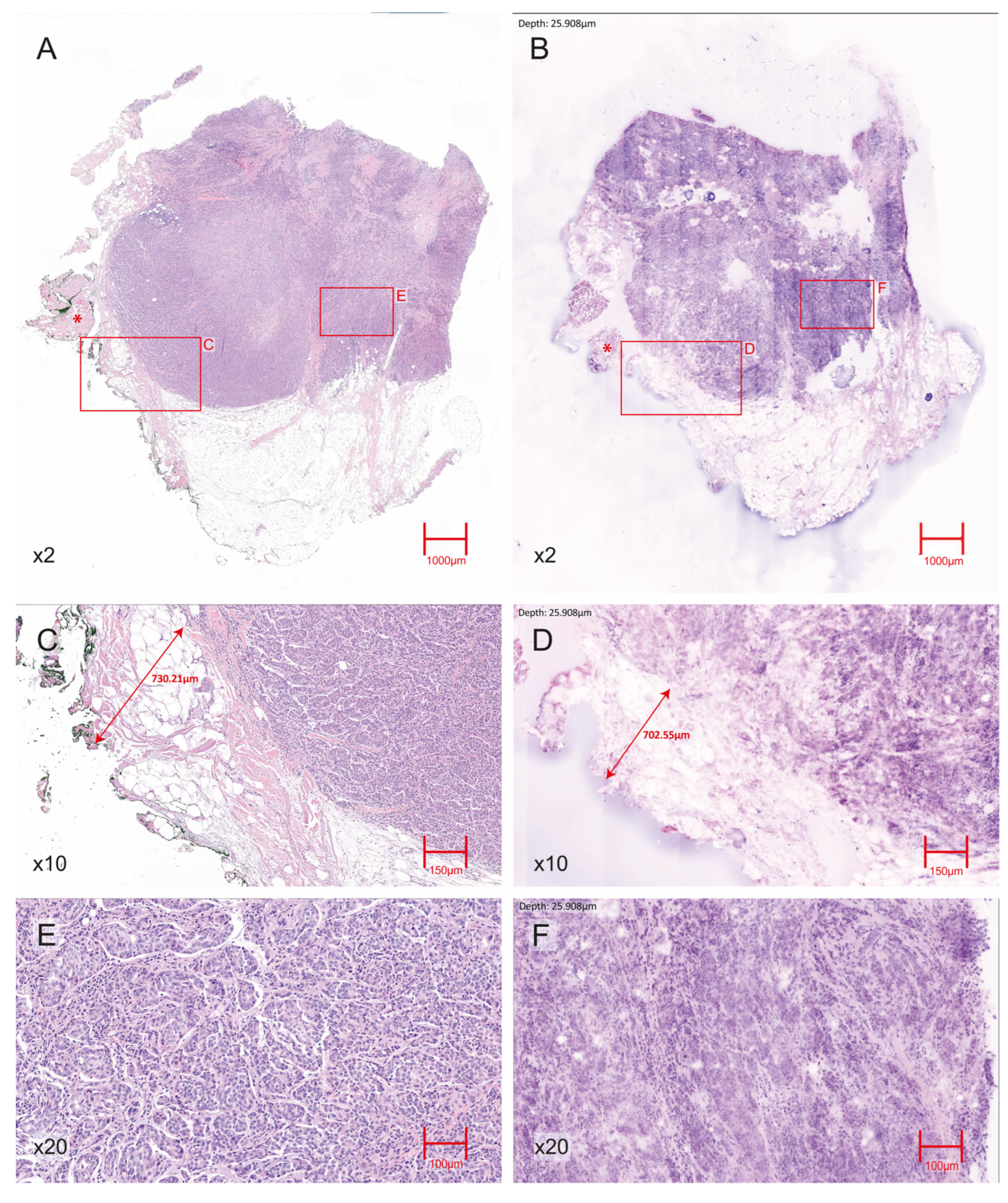 Cancers 17 03848 g001