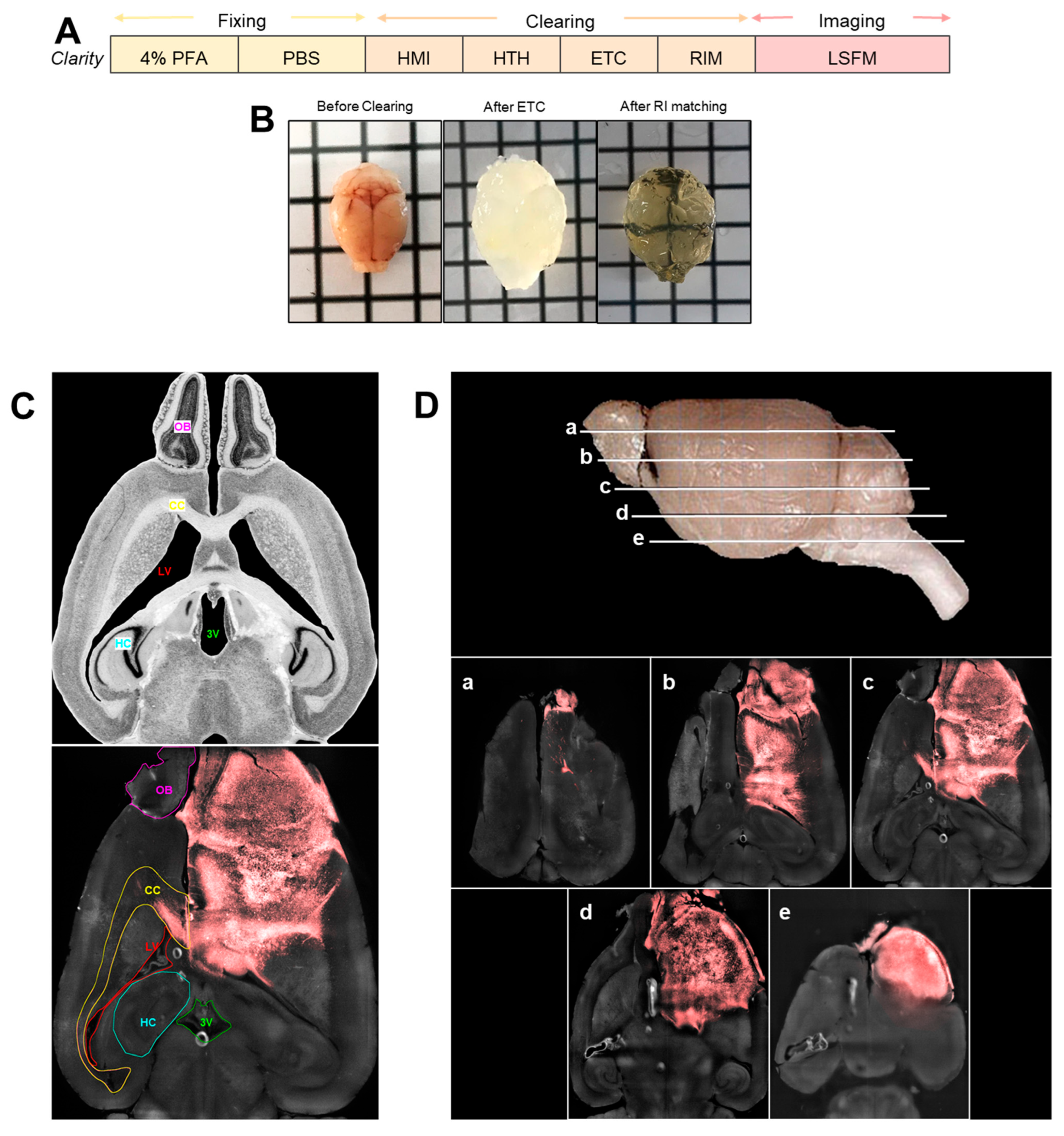 Cancers 17 03851 g002