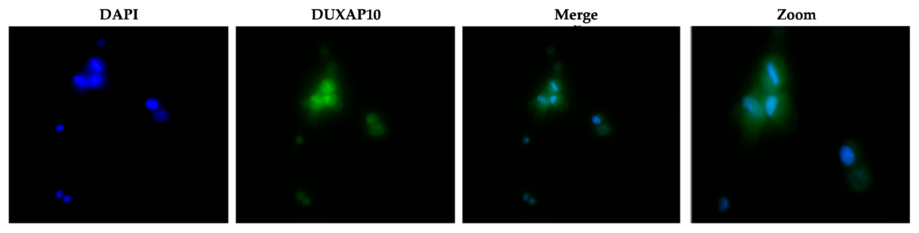 Cancers 17 03852 g005