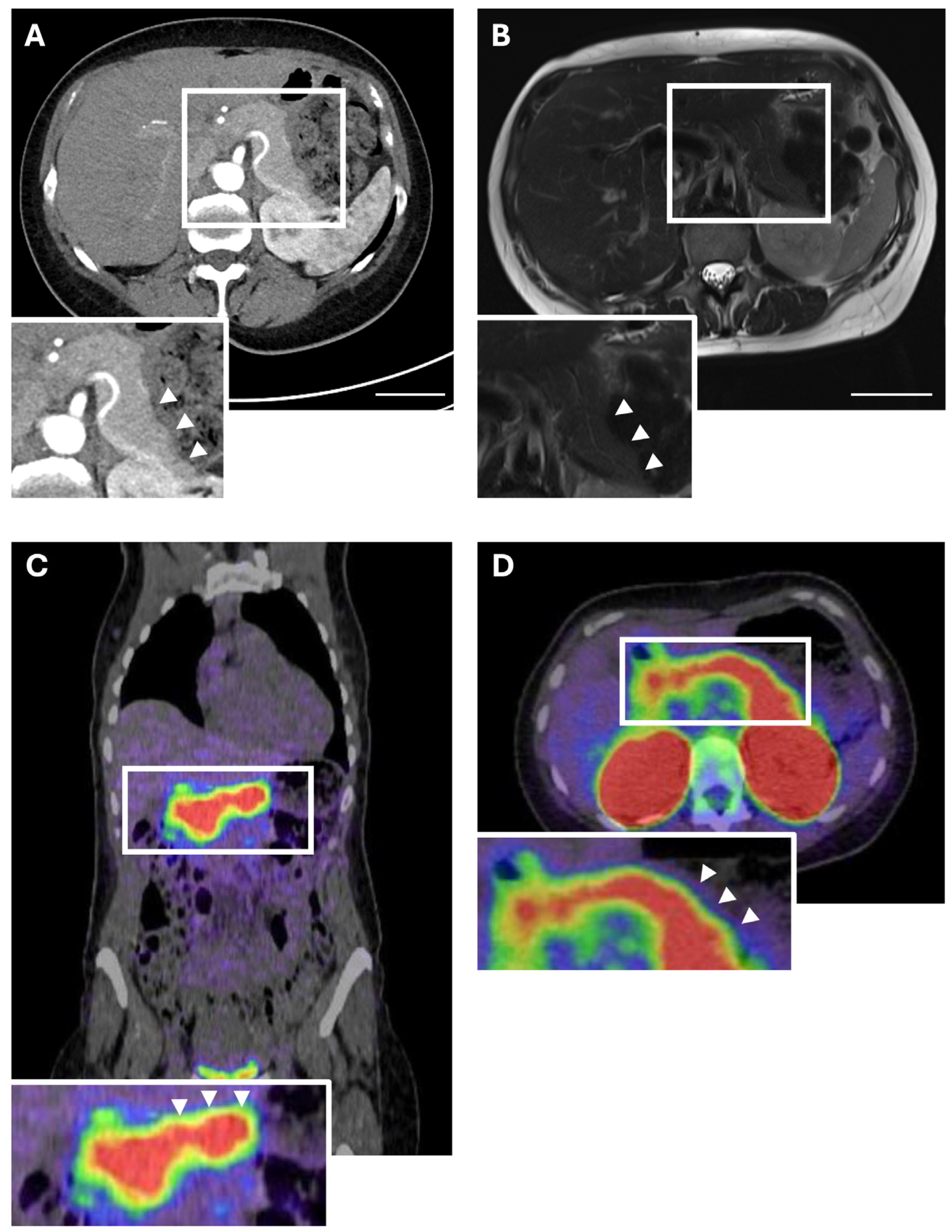 Cancers 17 03857 g002