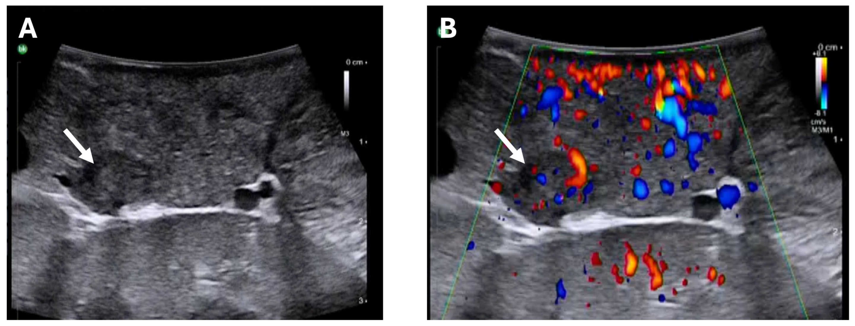 Cancers 17 03857 g003