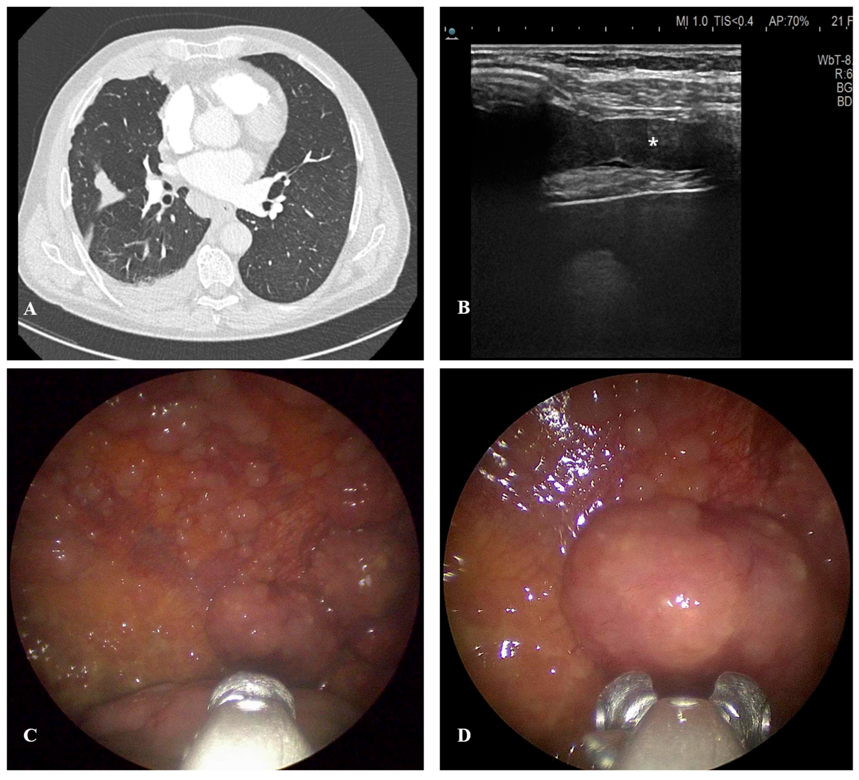 Cancers 17 03866 g001