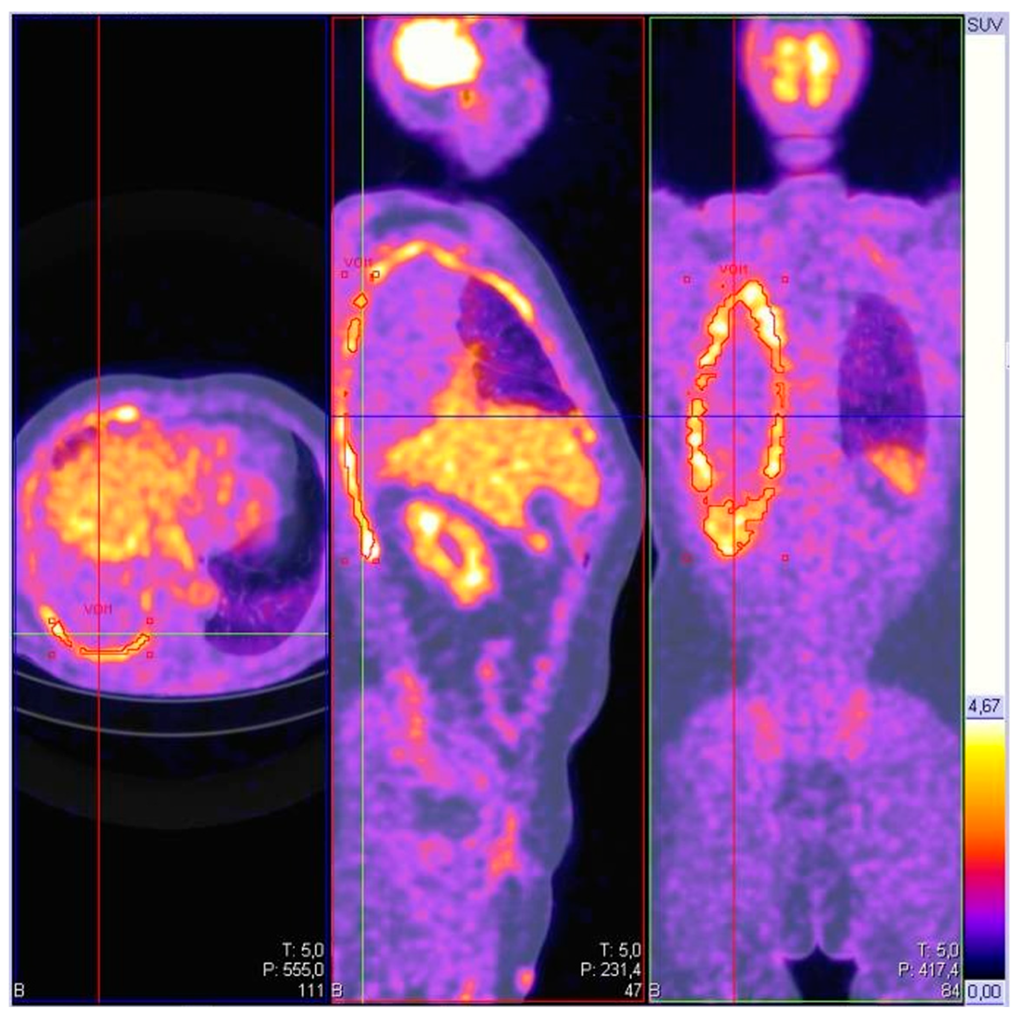 Cancers 17 03866 g002