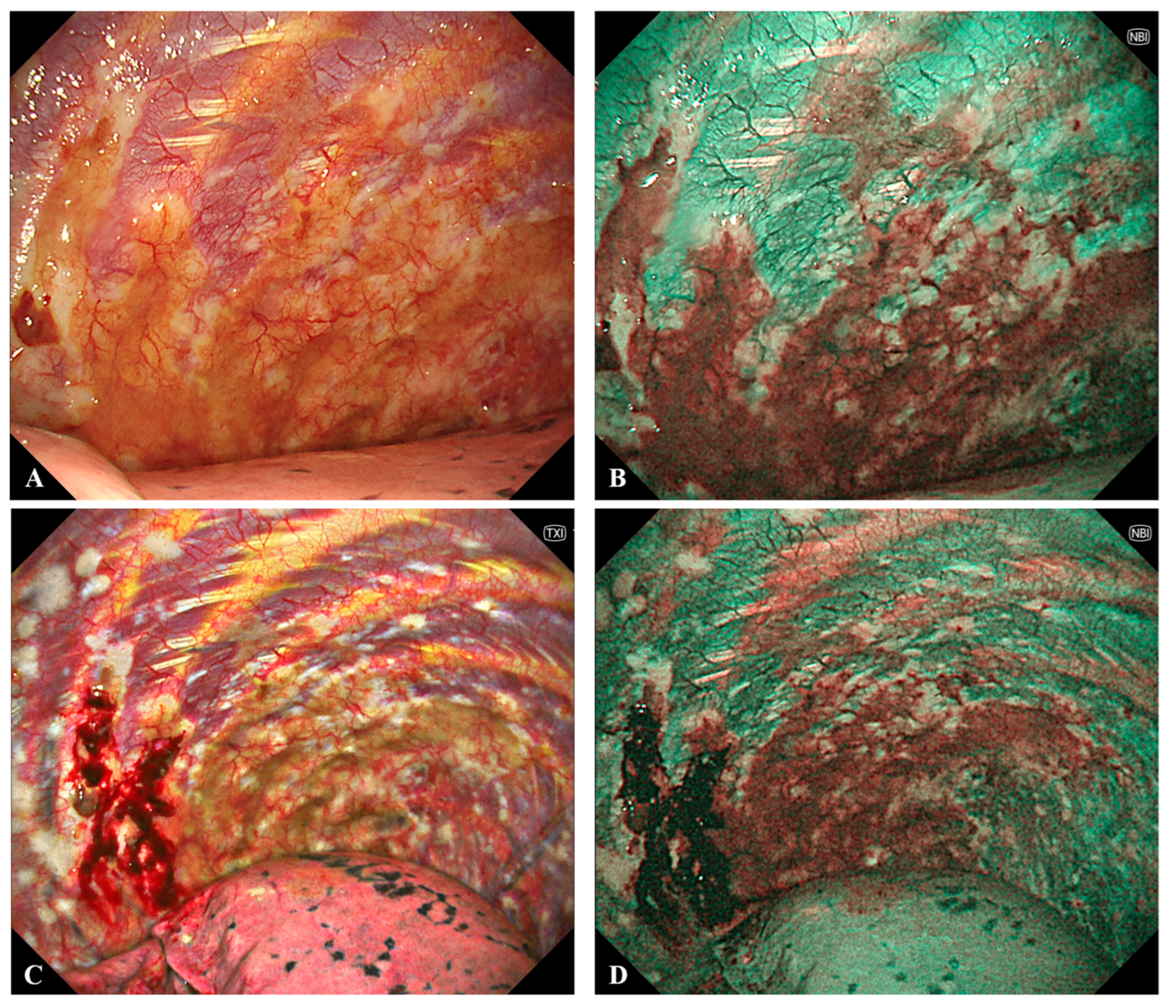 Cancers 17 03866 g003