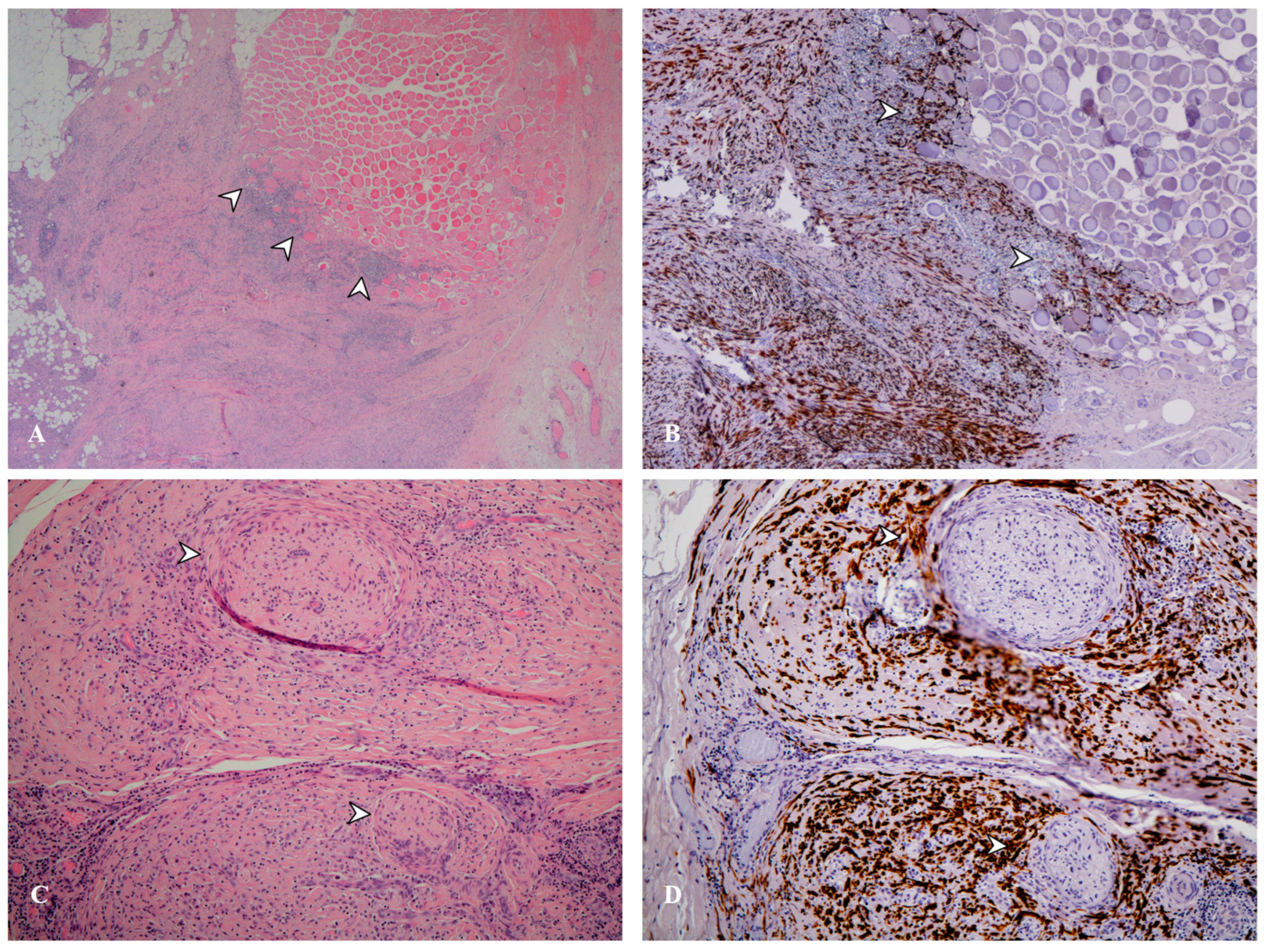 Cancers 17 03866 g005