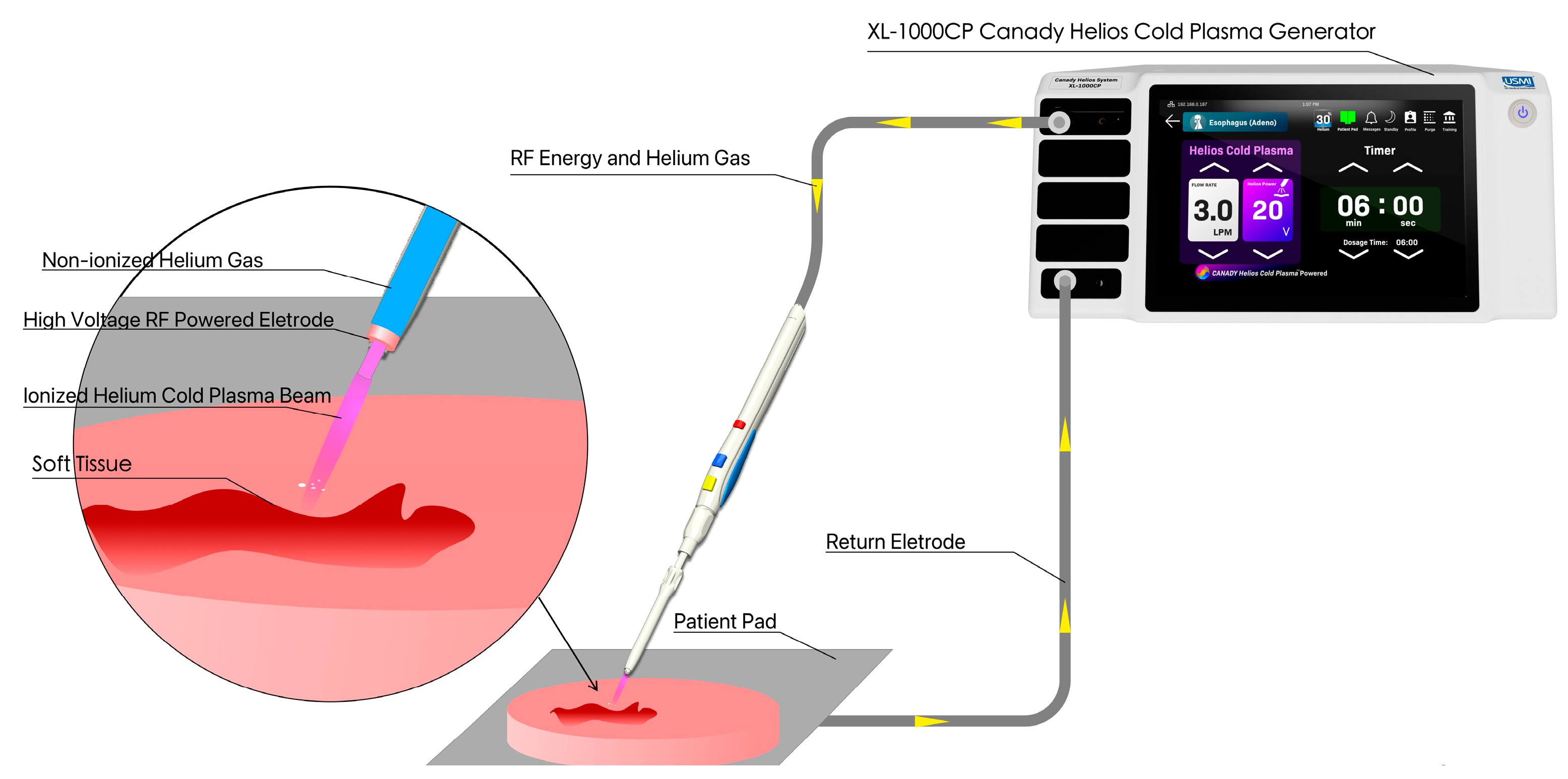 Cancers 17 03869 g001 Cancers 17 03869 g001