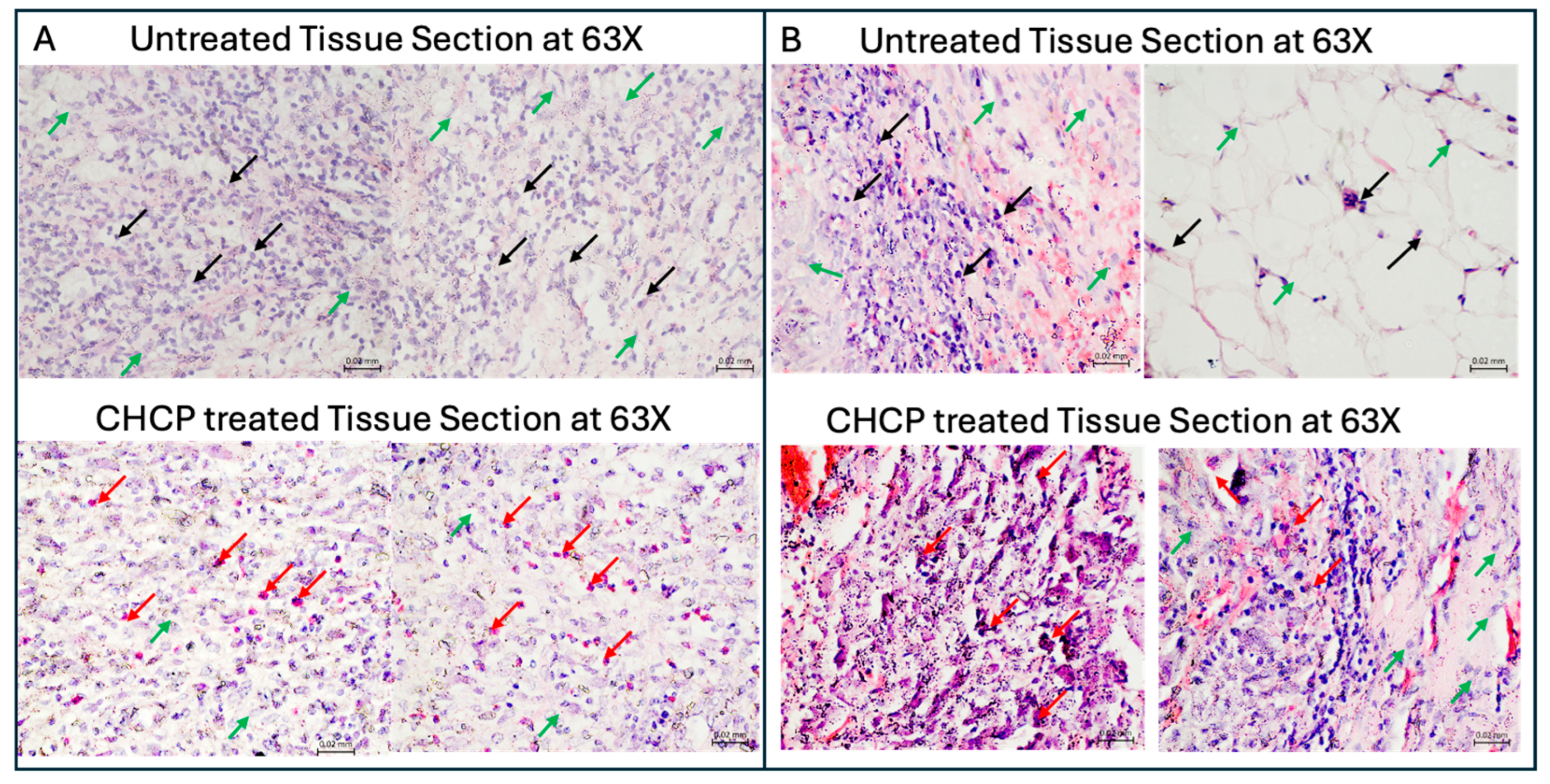 Cancers 17 03869 g010 Cancers 17 03869 g010