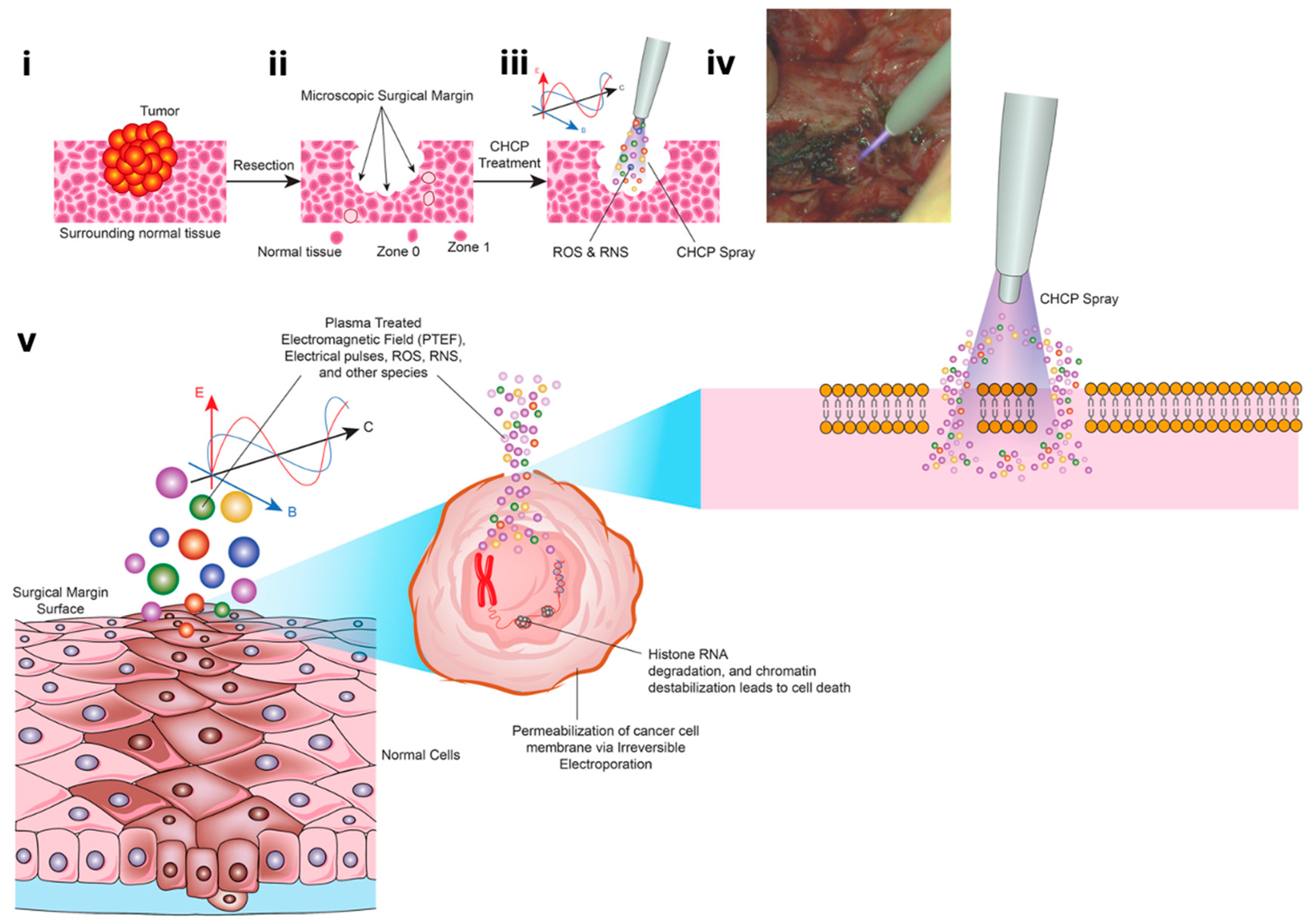 Cancers 17 03869 g011 Cancers 17 03869 g011