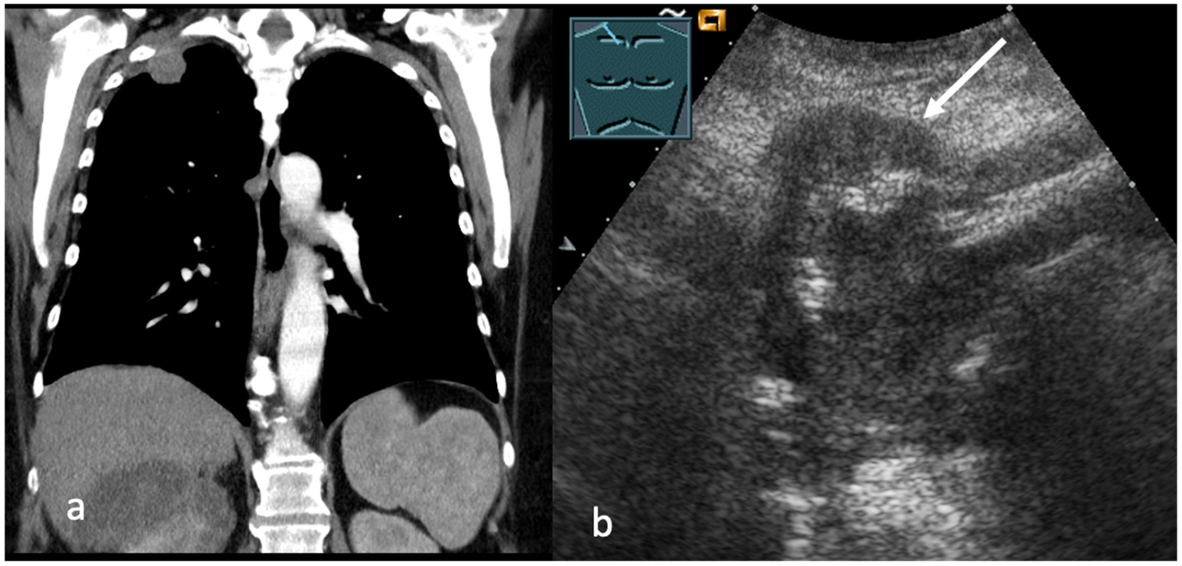 Cancers 17 03873 g001