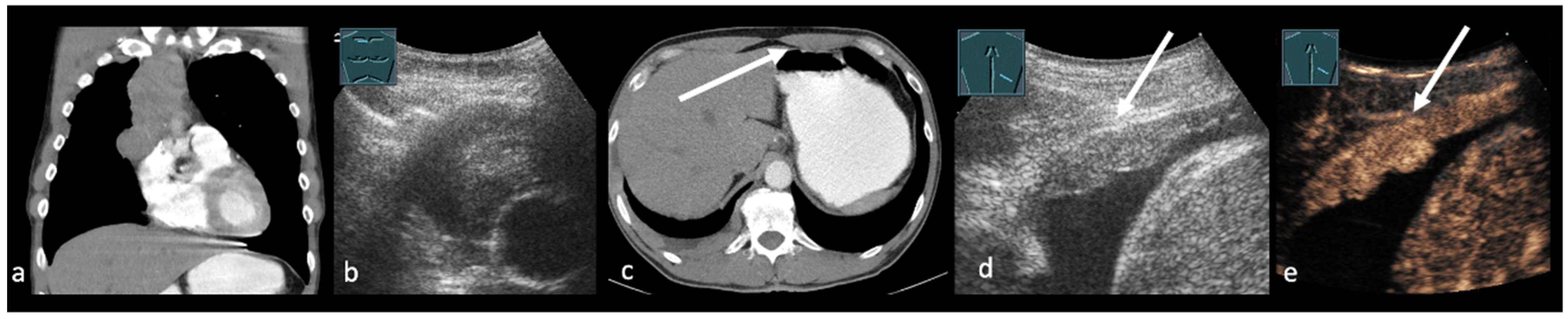 Cancers 17 03873 g002