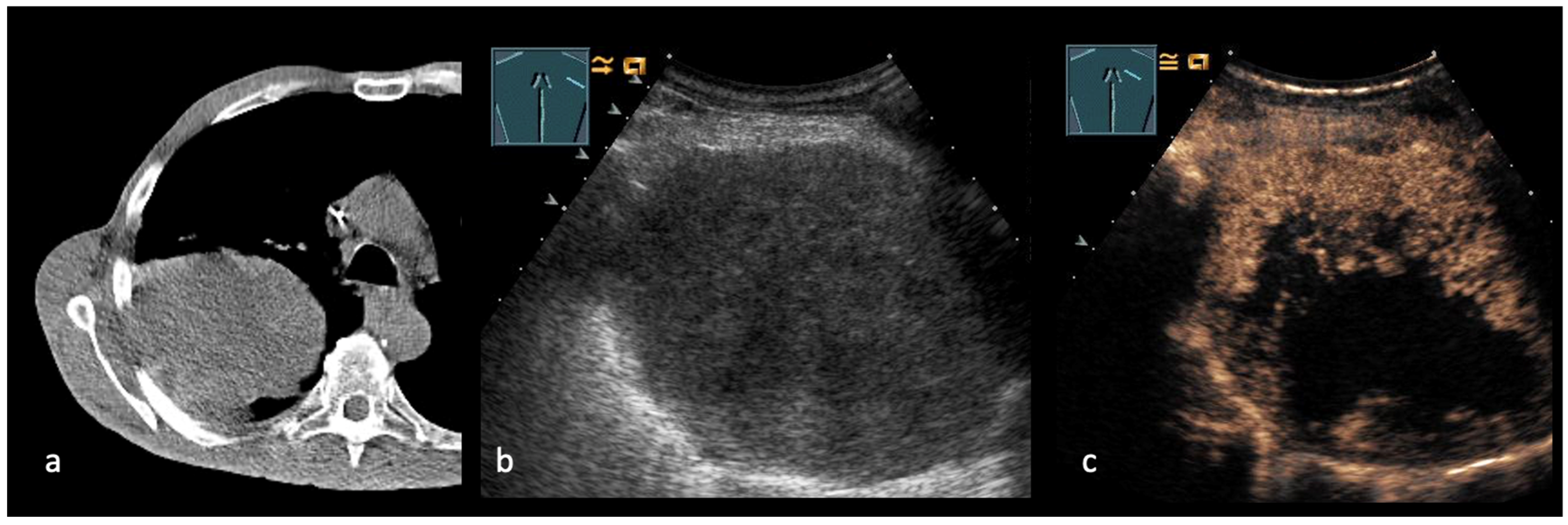 Cancers 17 03873 g003