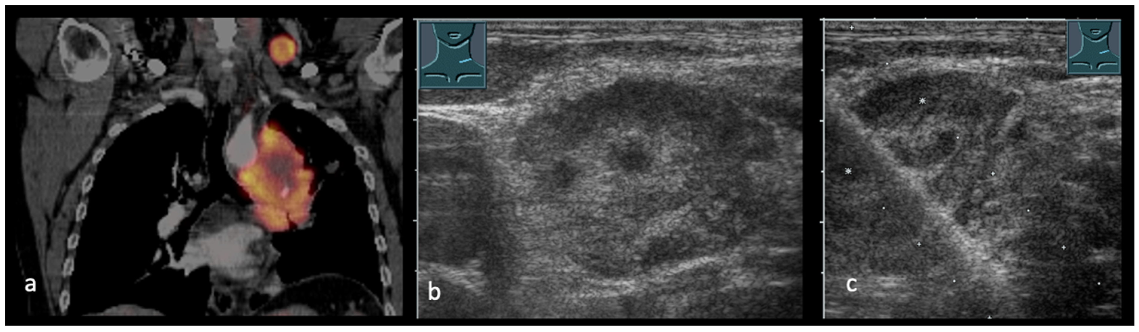 Cancers 17 03873 g004