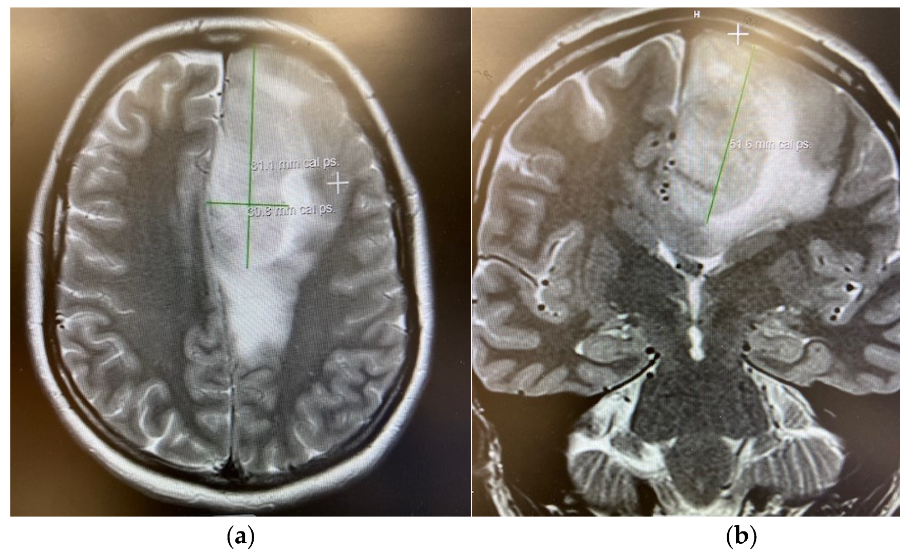 Cancers 17 03880 g004 Cancers 17 03880 g004