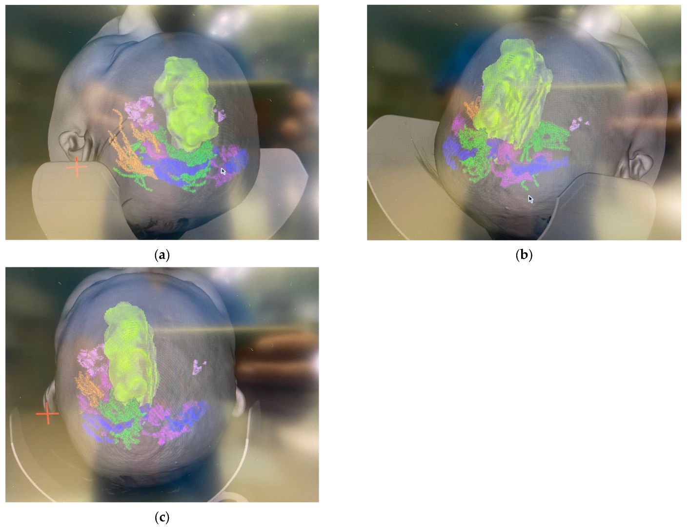 Cancers 17 03880 g005 Cancers 17 03880 g005