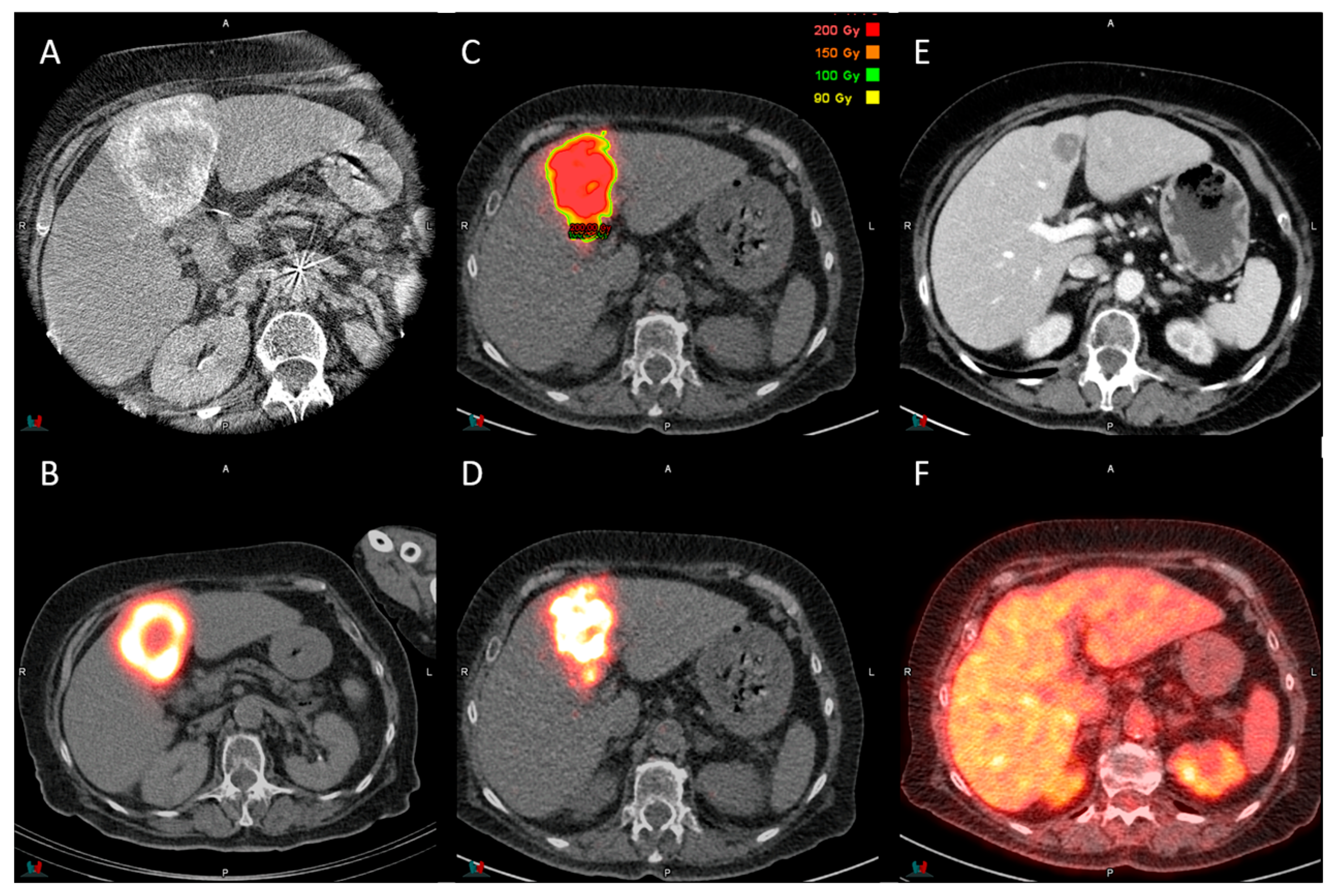Cancers 17 03889 g001 Cancers 17 03889 g001