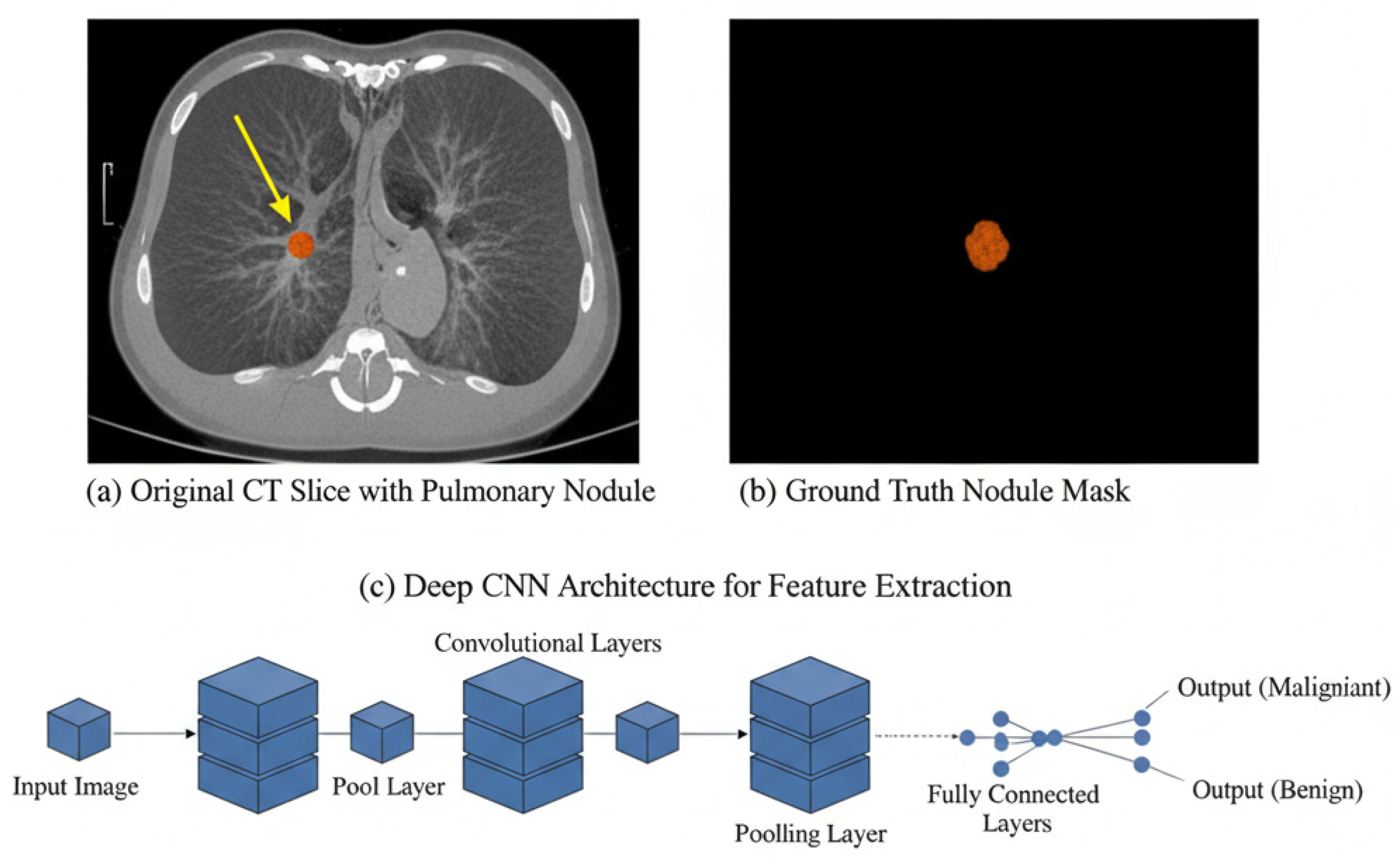 Cancers 17 03985 g002