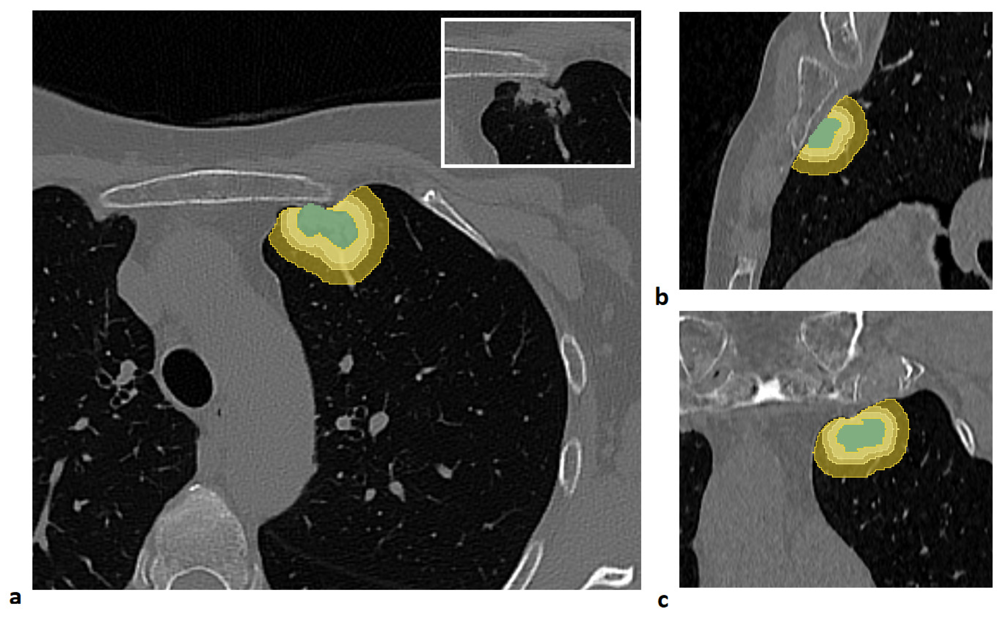 Cancers 17 04001 g001