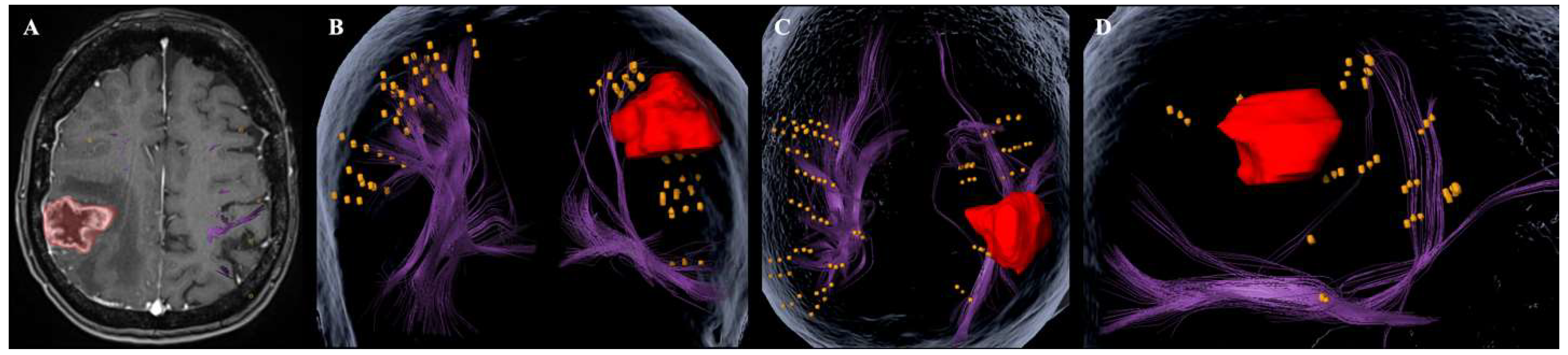 Cancers 17 04007 g001 Cancers 17 04007 g001